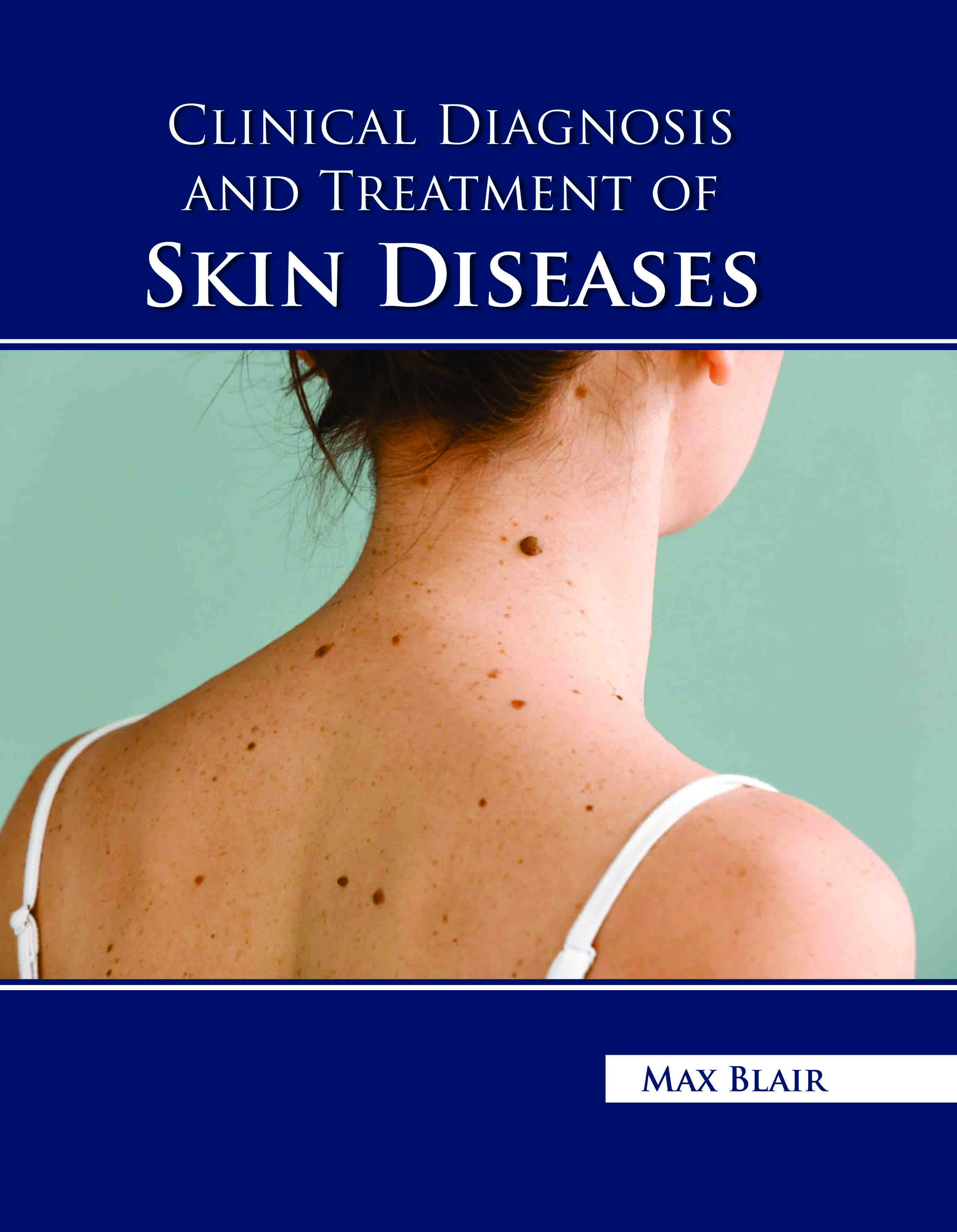 Clinical Diagnosis and Treatment of Skin Diseases