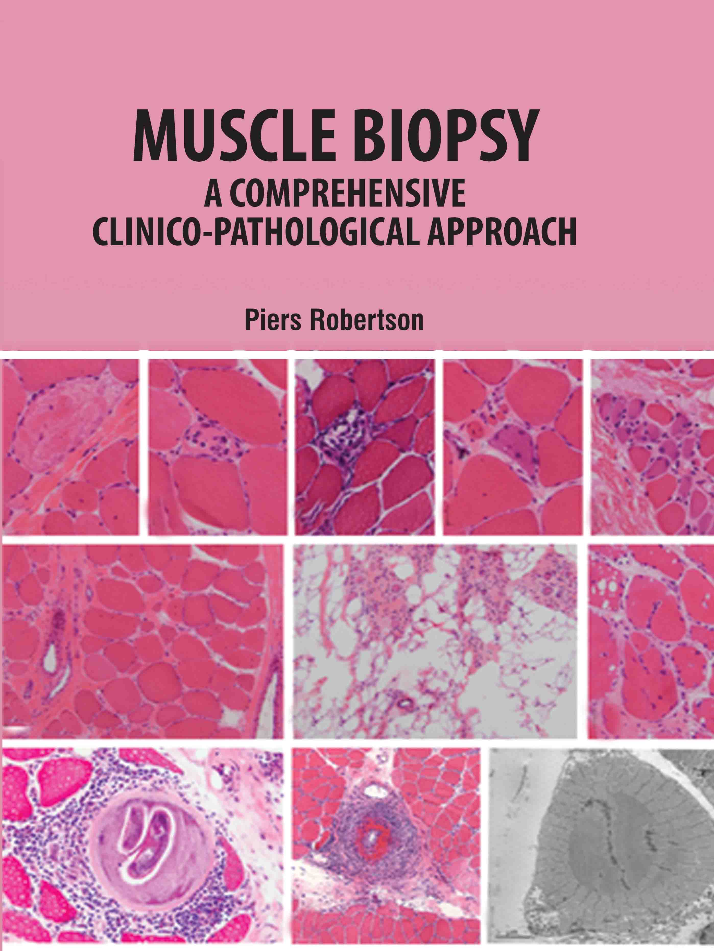 Muscle Biopsy: A Comprehensive Clinico-Pathological Approach