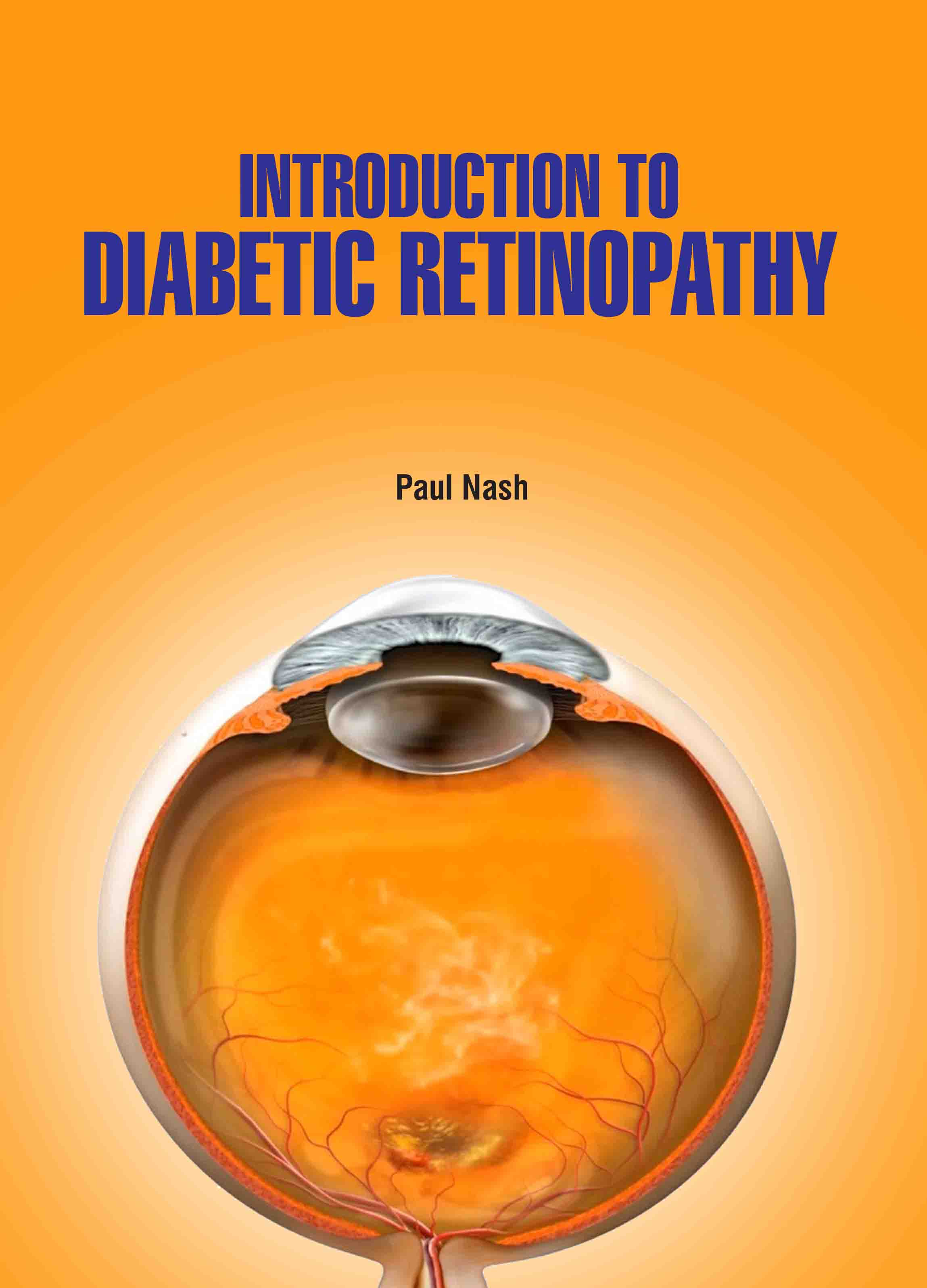 Introduction to Diabetic Retinopathy