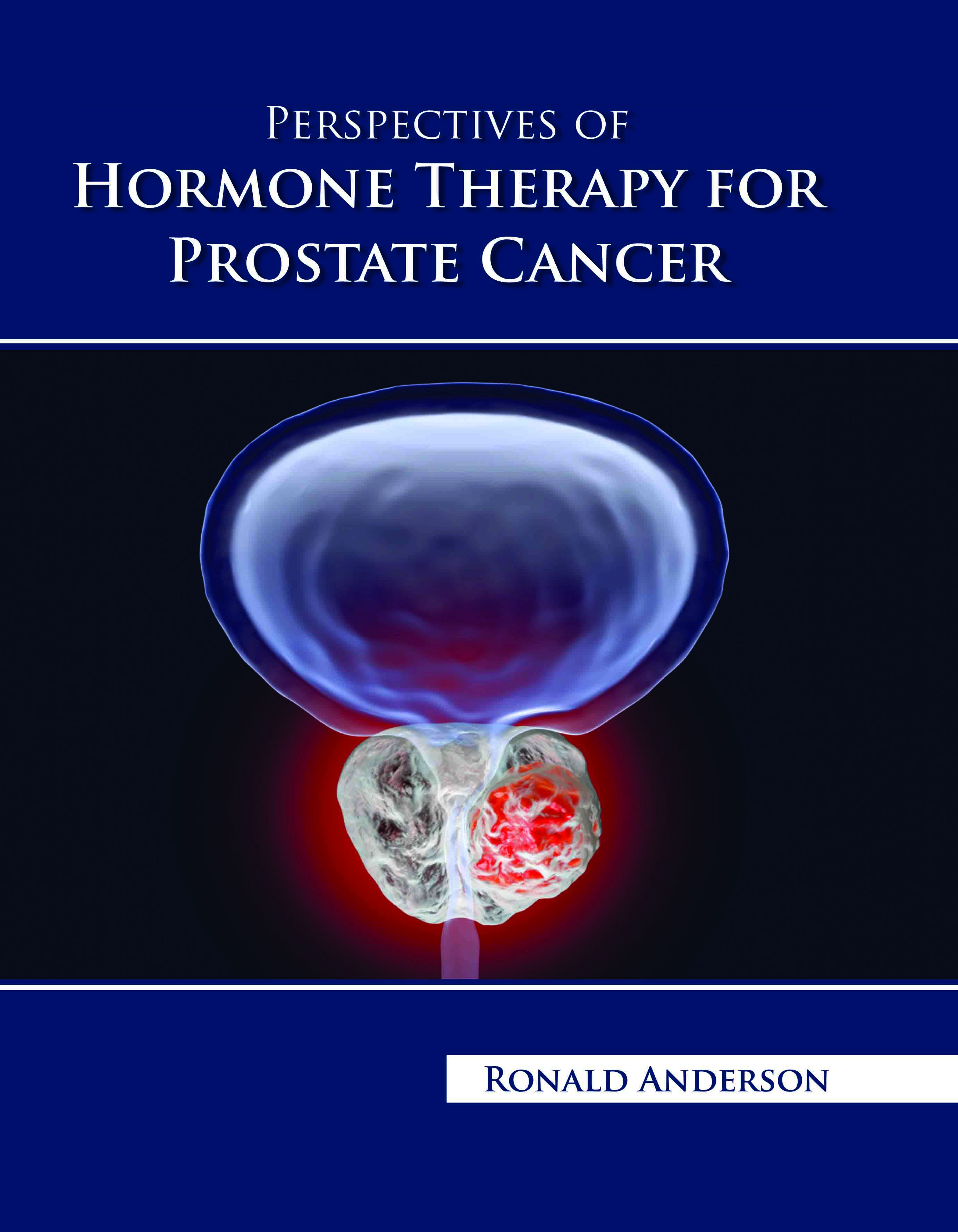 Perspectives of Hormone Therapy for Prostate Cancer