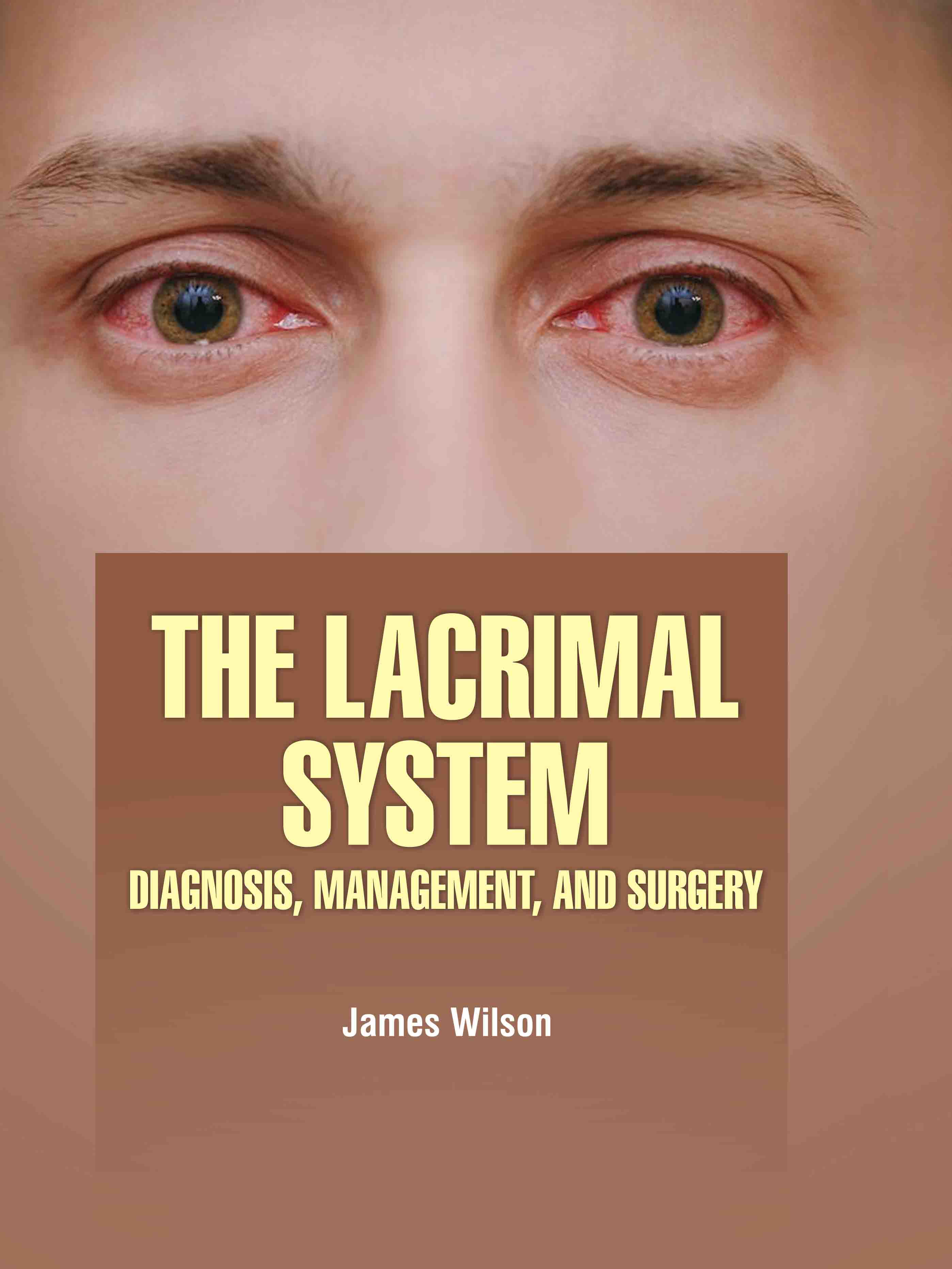 The Lacrimal System: Diagnosis, Management, and Surgery