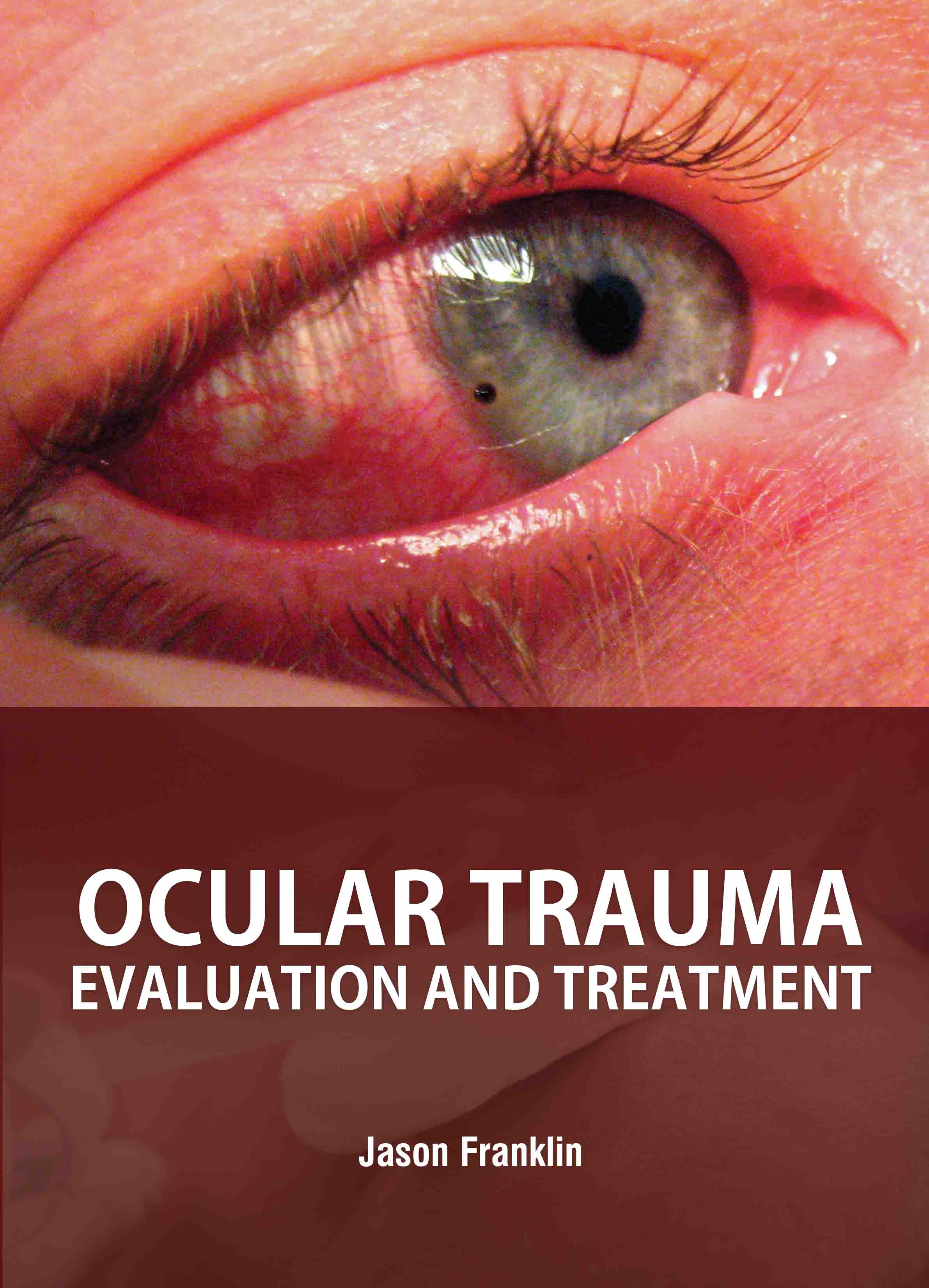 Ocular Trauma: Evaluation and Treatment
