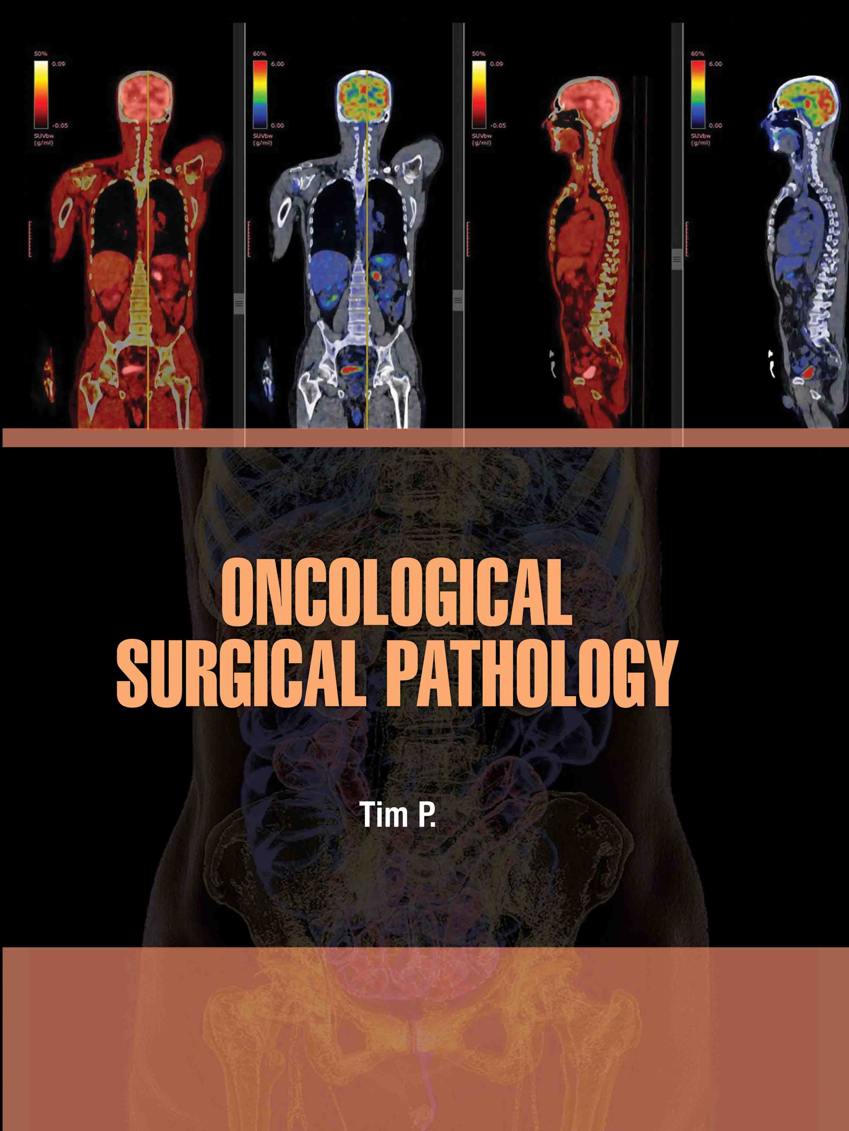 Oncological Surgical Pathology