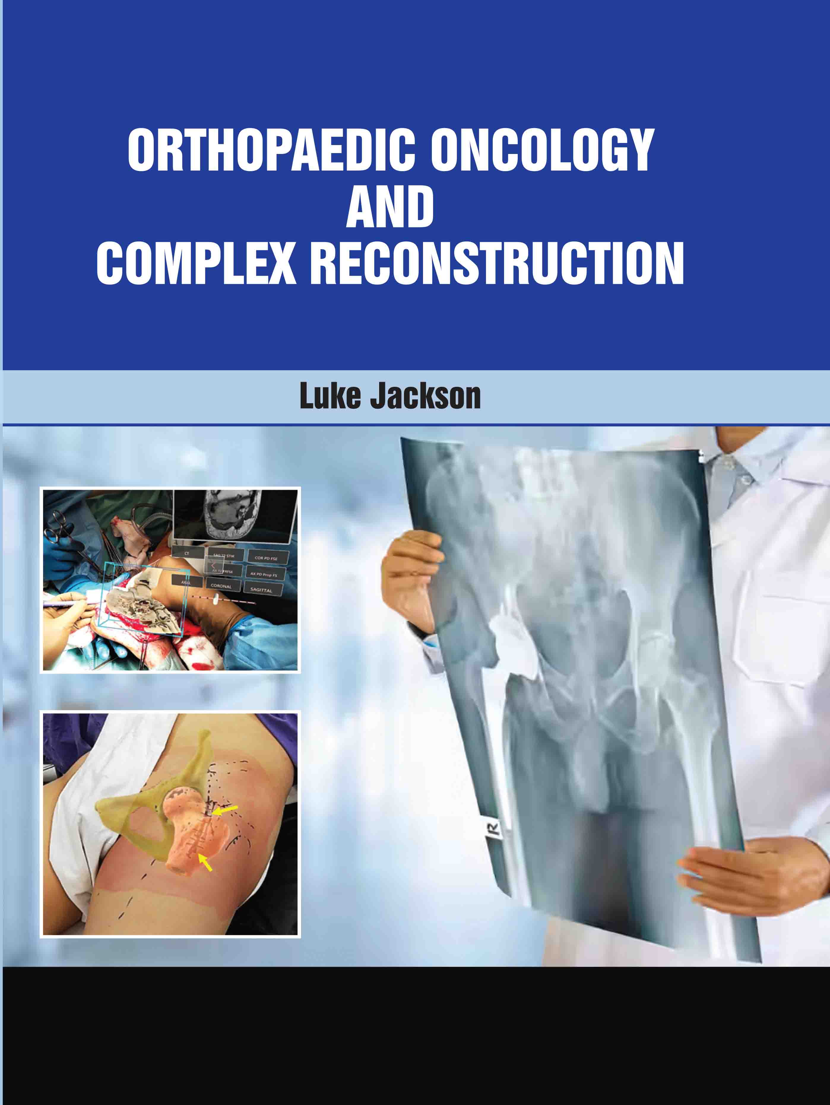 Orthopedic Oncology and Complex Reconstruction