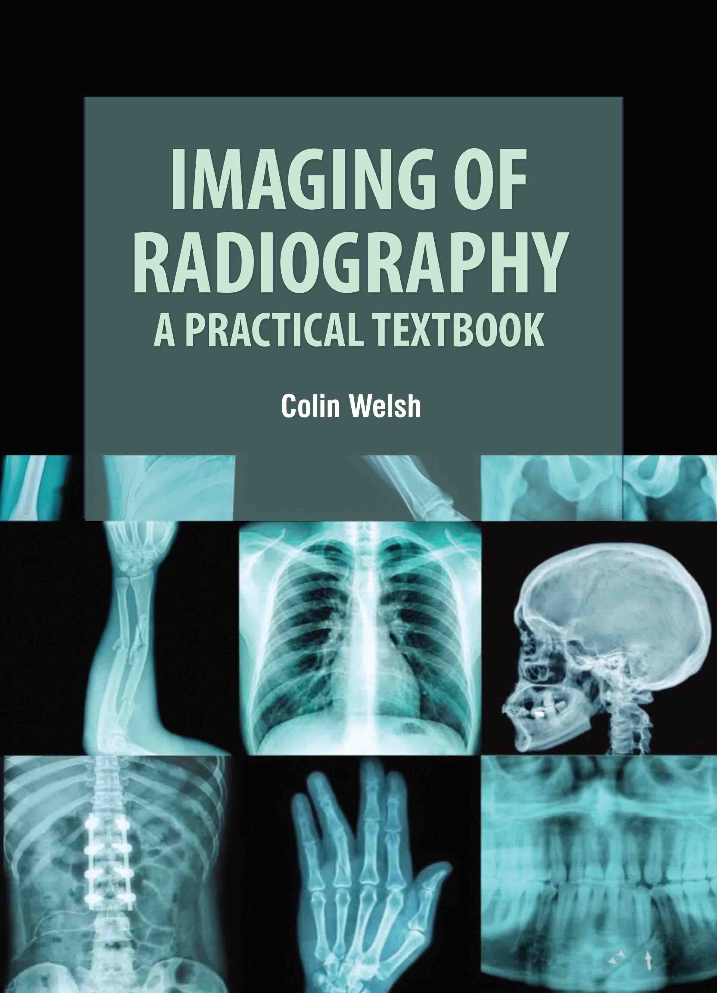 Imaging of Radiography: A Practical Textbook