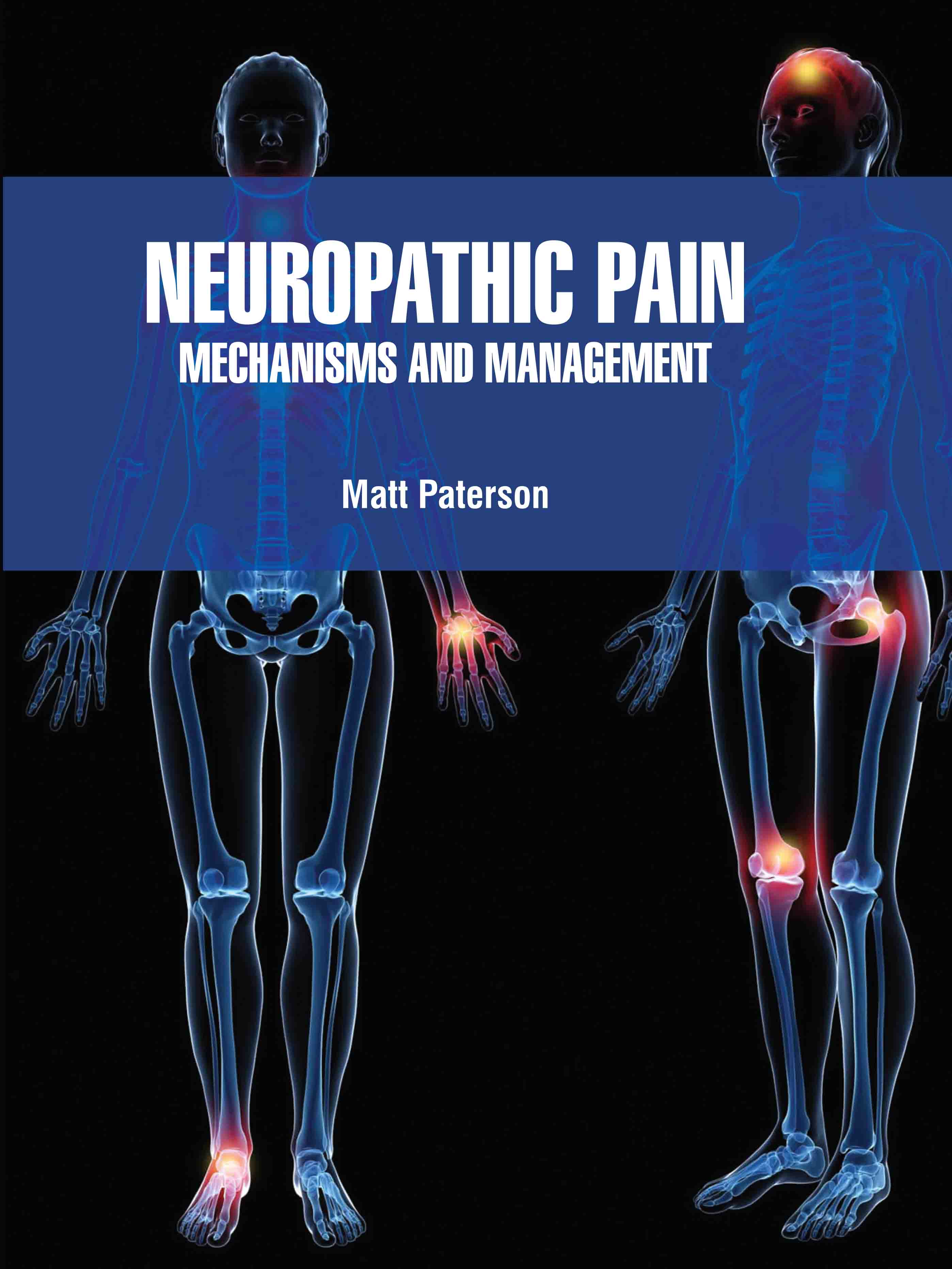 Neuropathic Pain: Mechanisms and Management