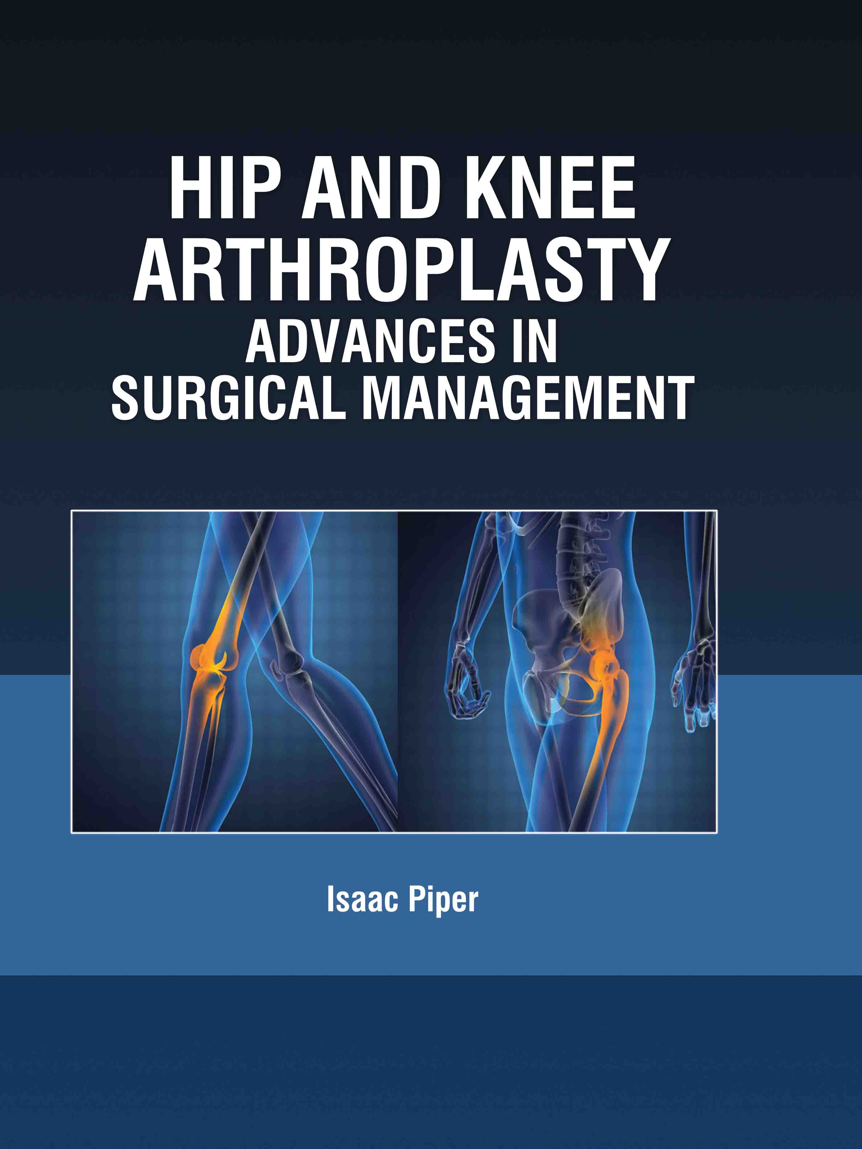 Hip and Knee Arthroplasty: Advances in Surgical Management