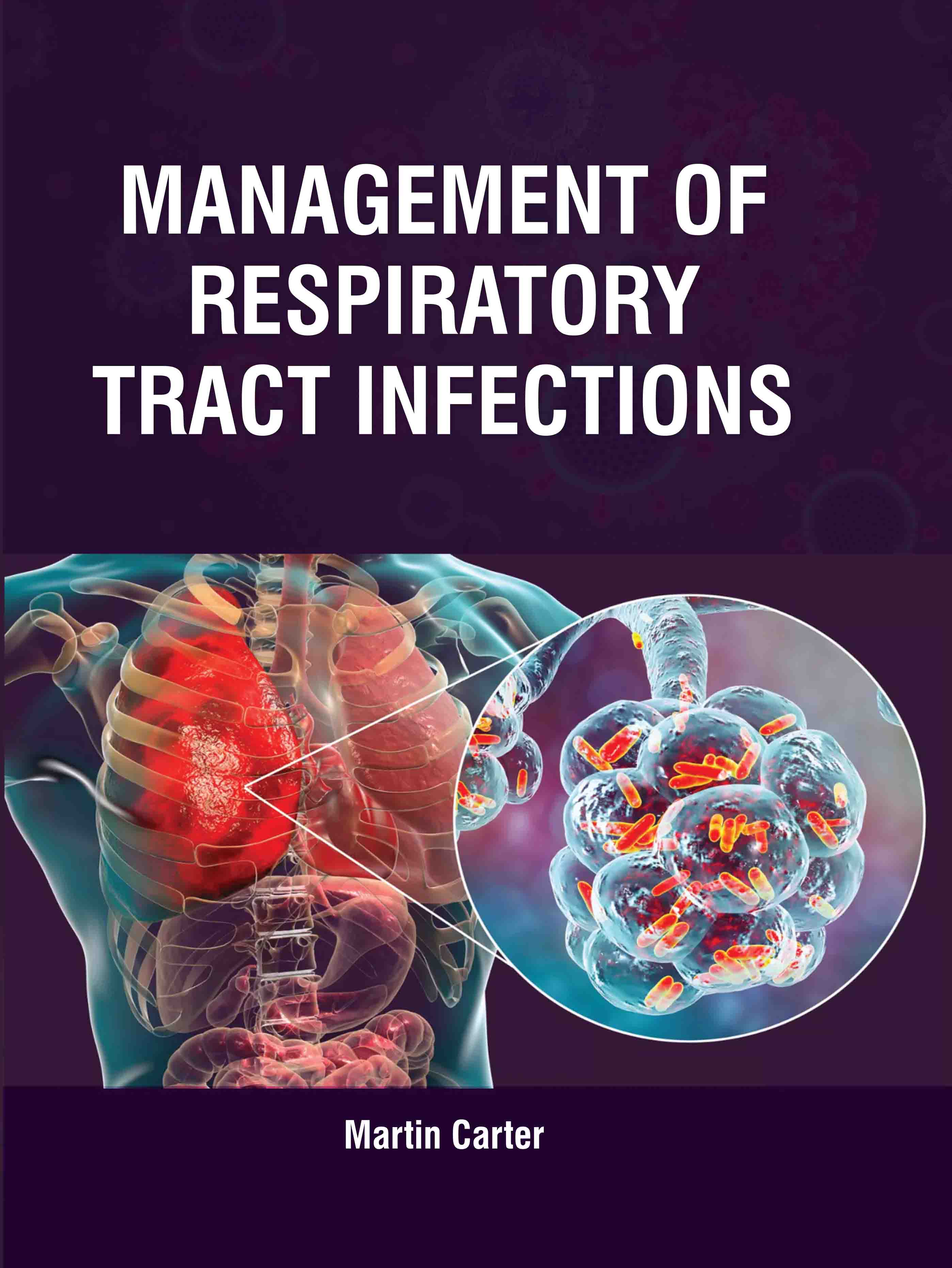 Management of Respiratory Tract Infections