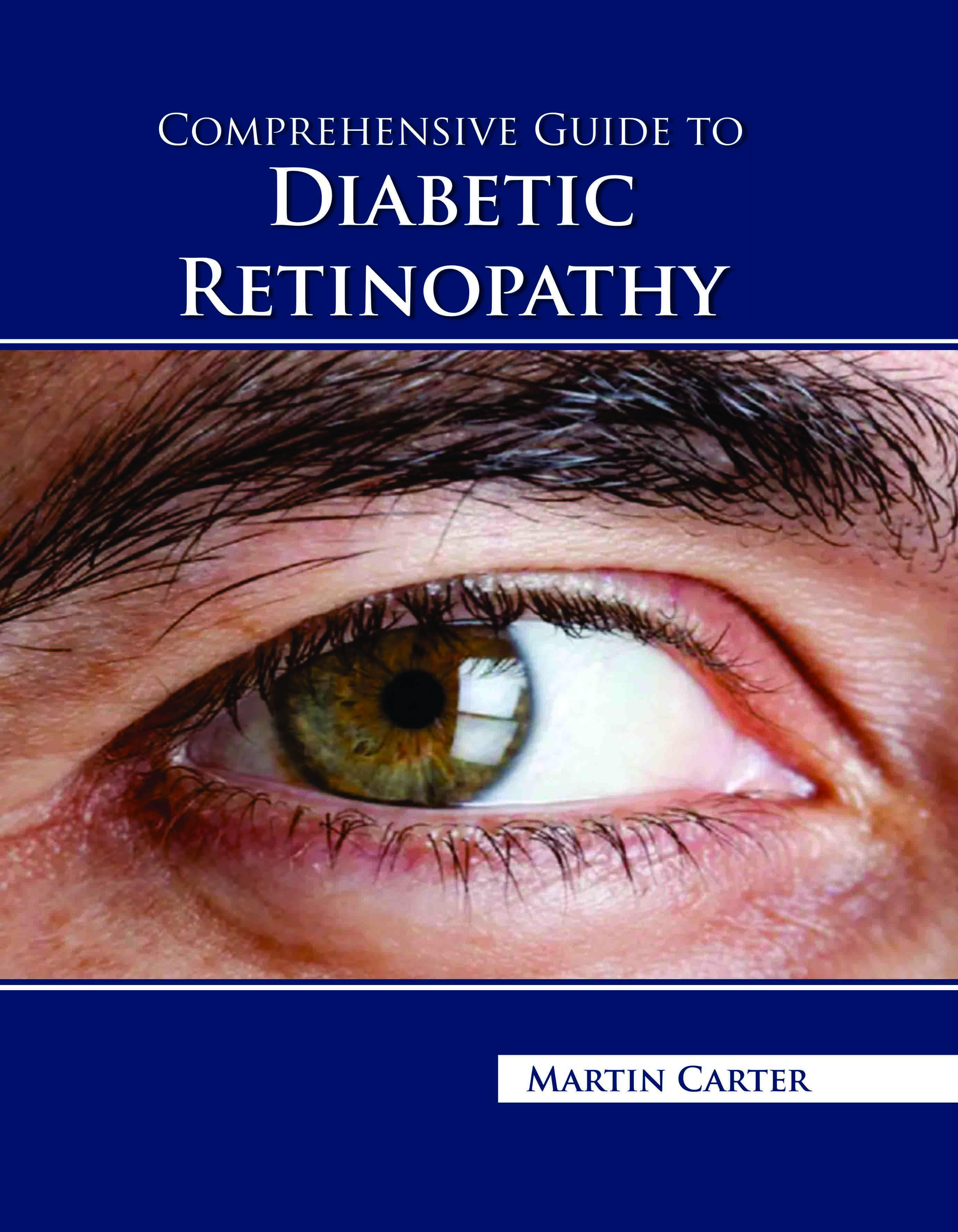 Comprehensive Guide to Diabetic Retinopathy
