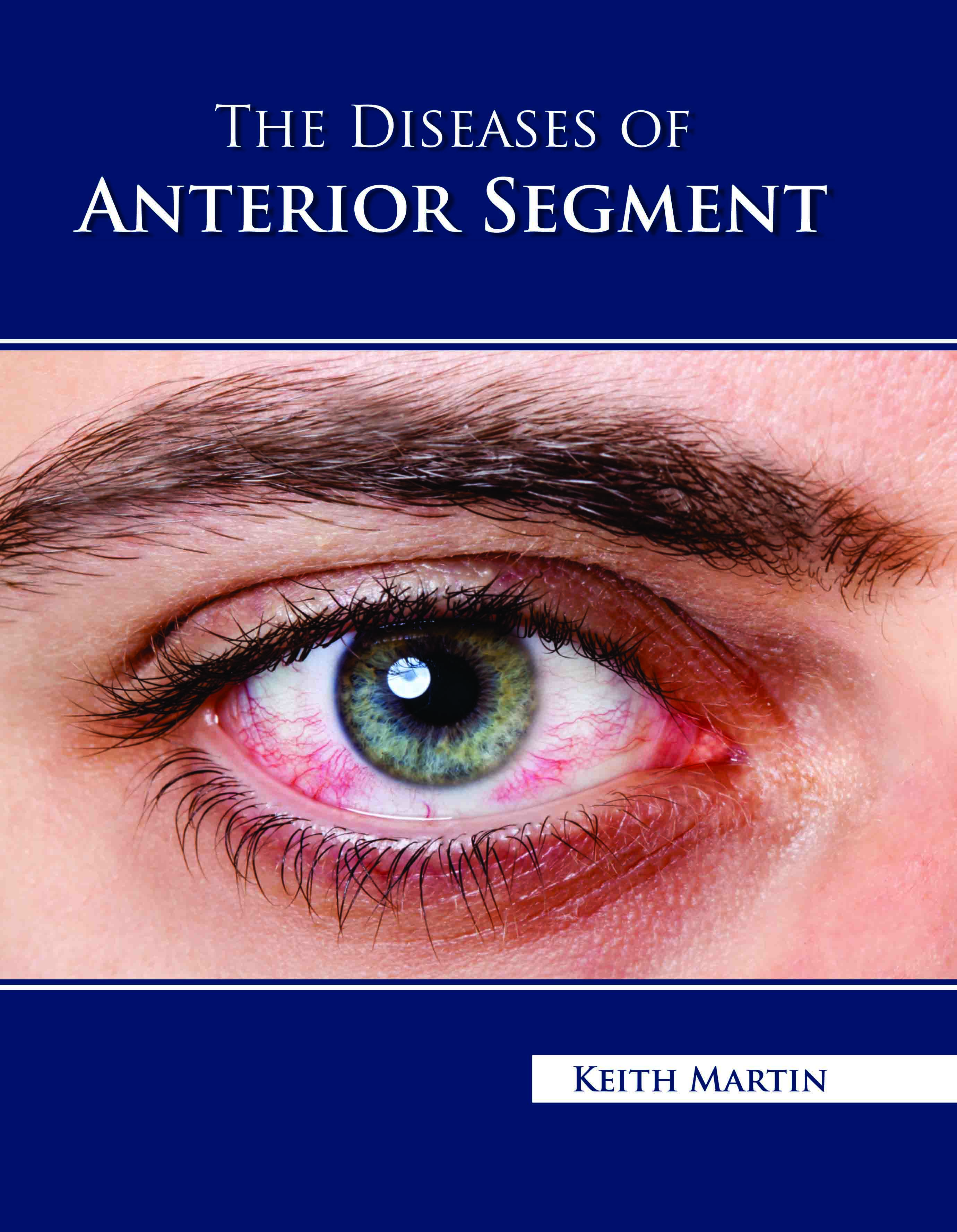 The Diseases of Anterior Segment