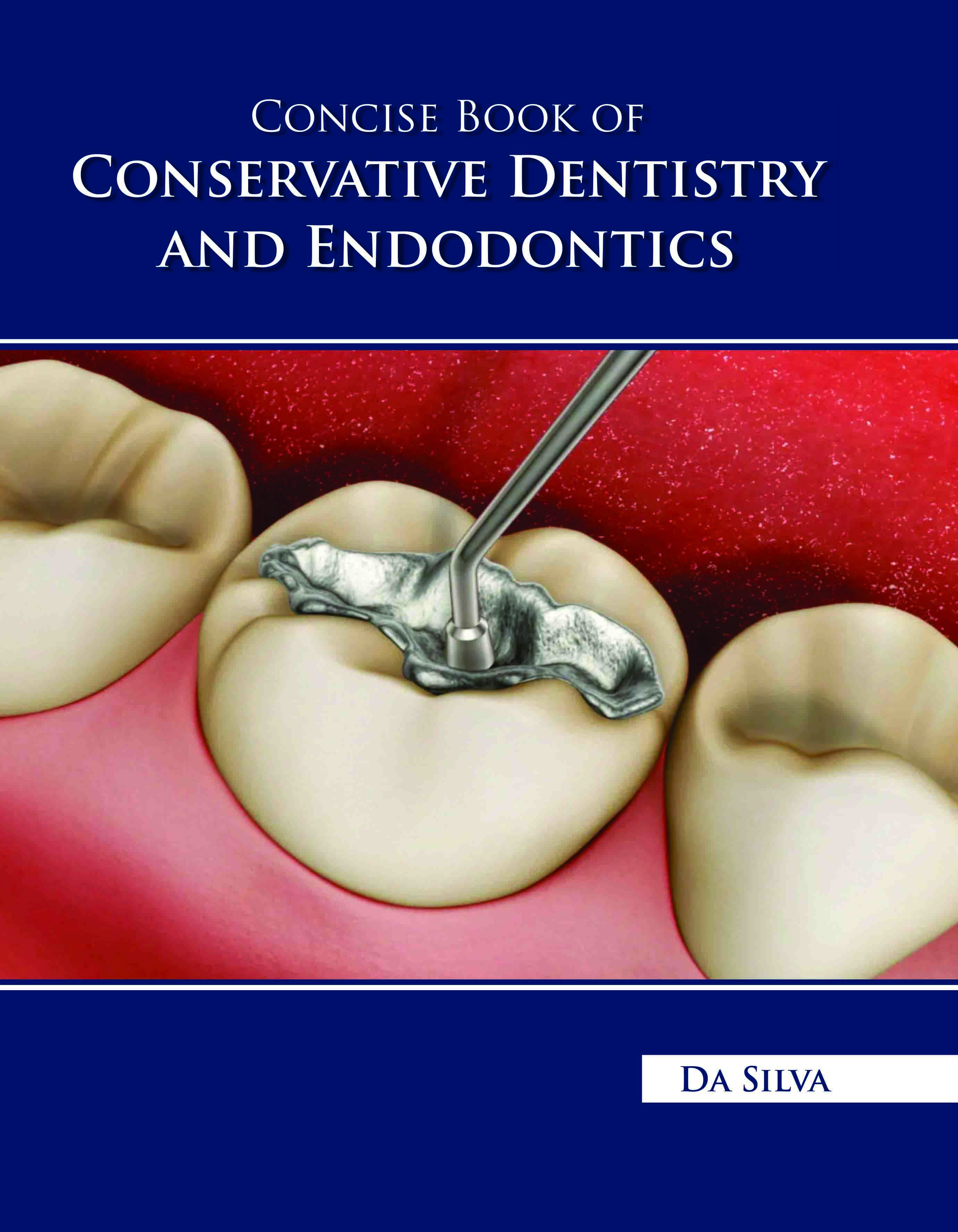 Concise Book of Conservative Dentistry and Endodontics
