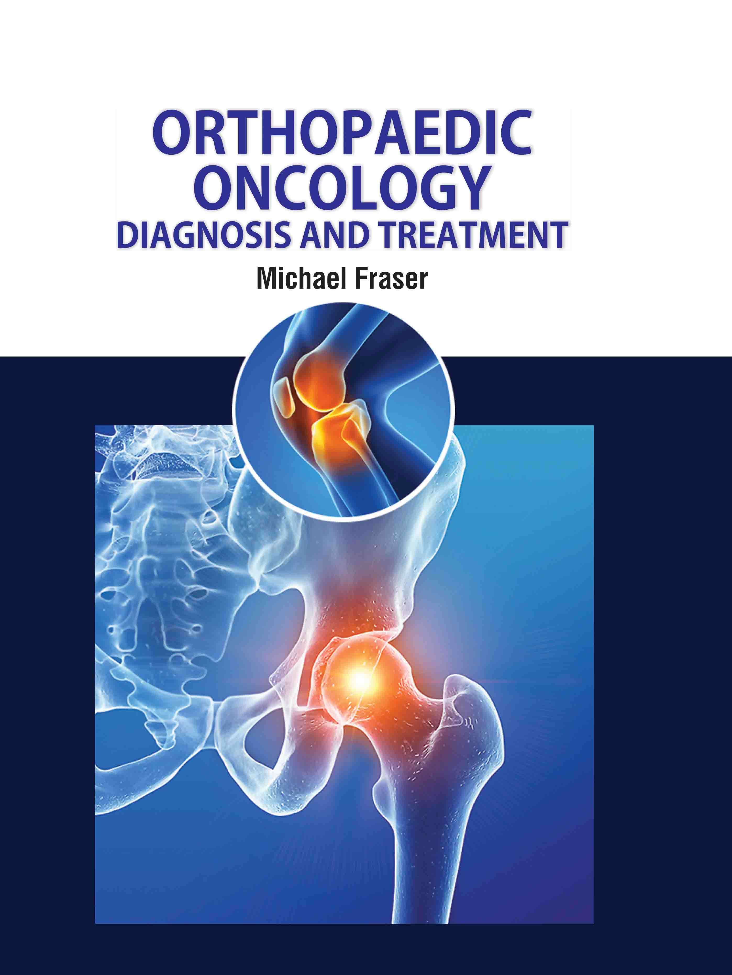 Orthopedic Oncology: Diagnosis and Treatment