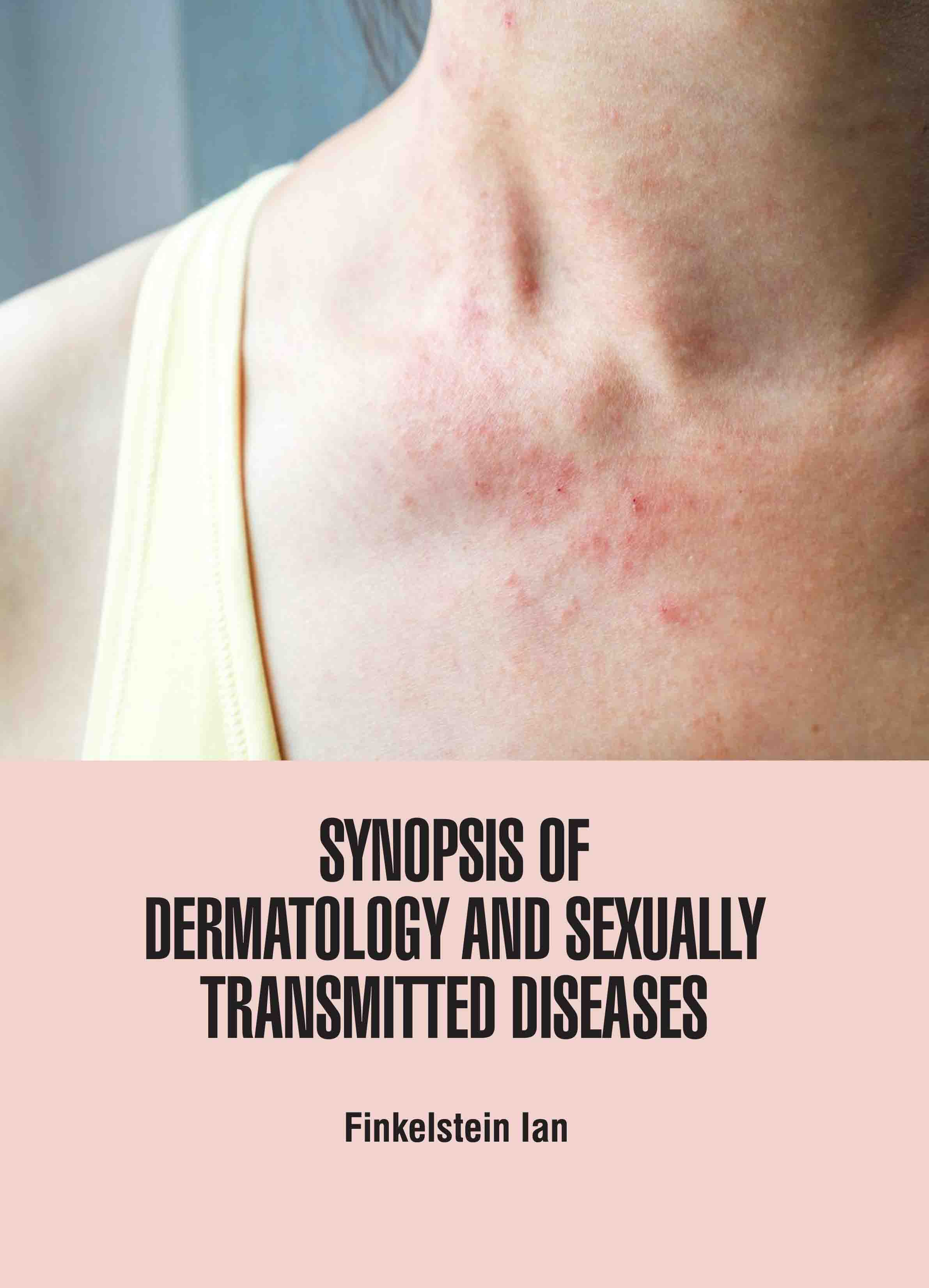 Synopsis of Dermatology and Sexually Transmitted Diseases