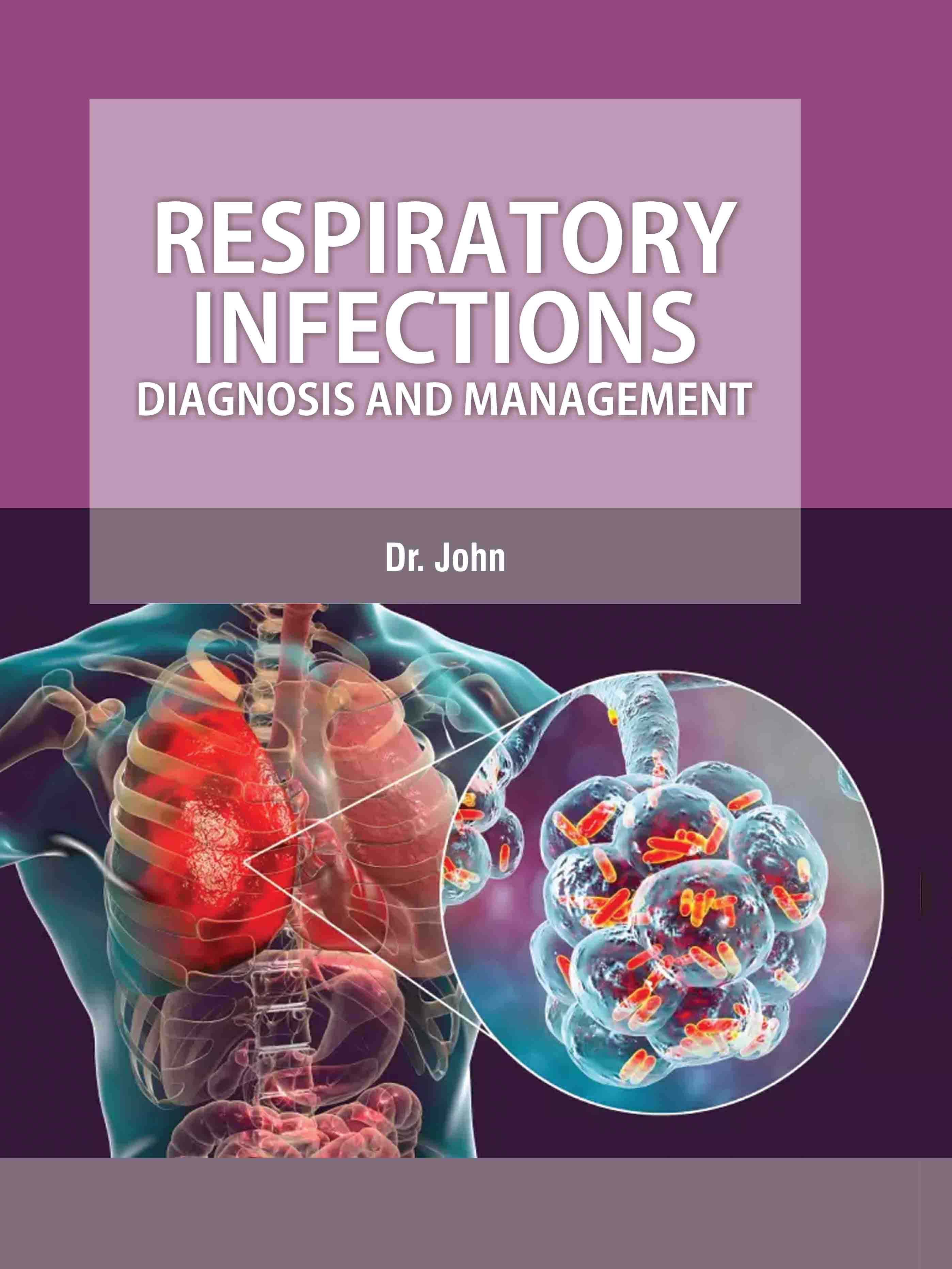 Respiratory Infections: Diagnosis and Management