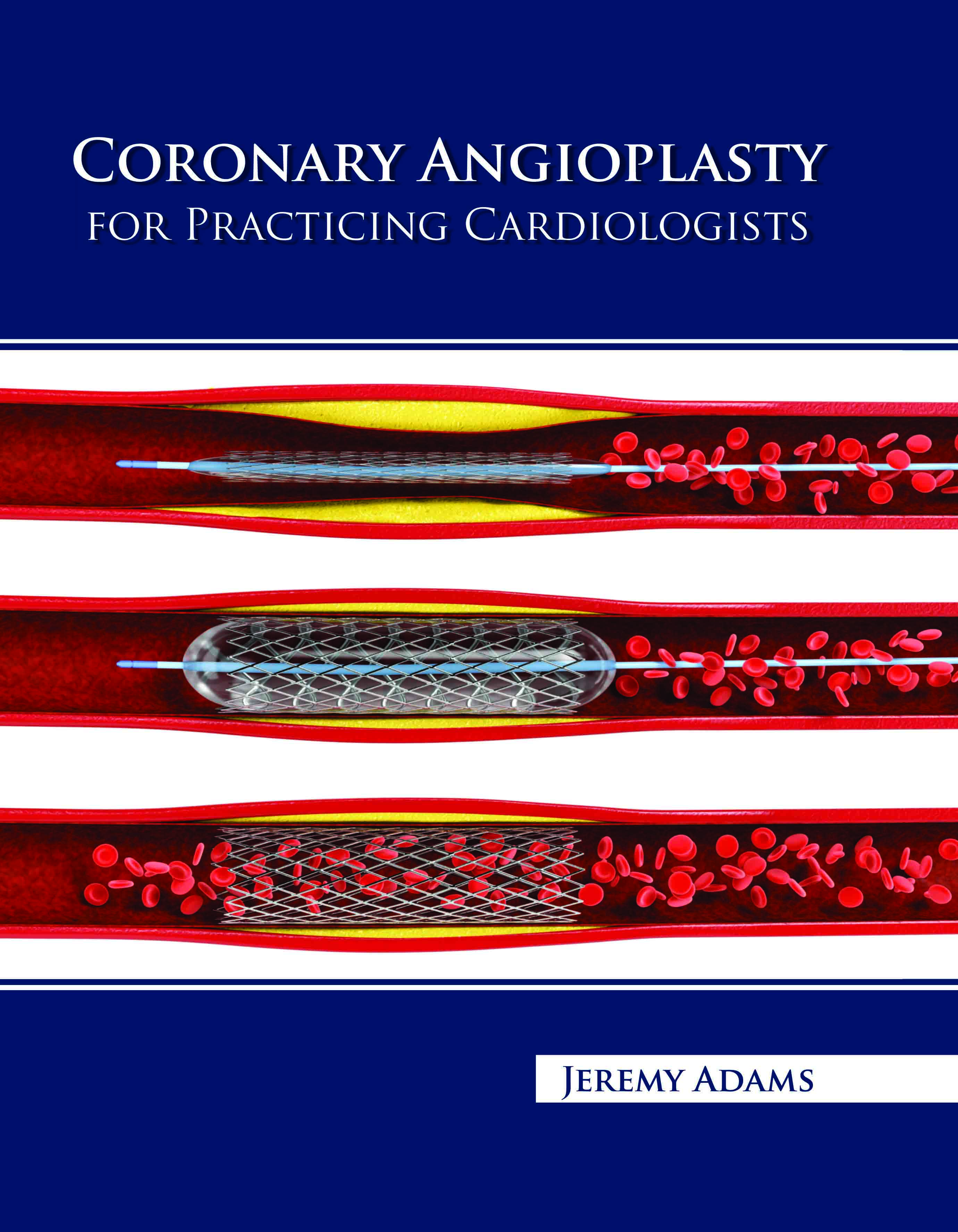 Coronary Angioplasty for Practicing Cardiologists