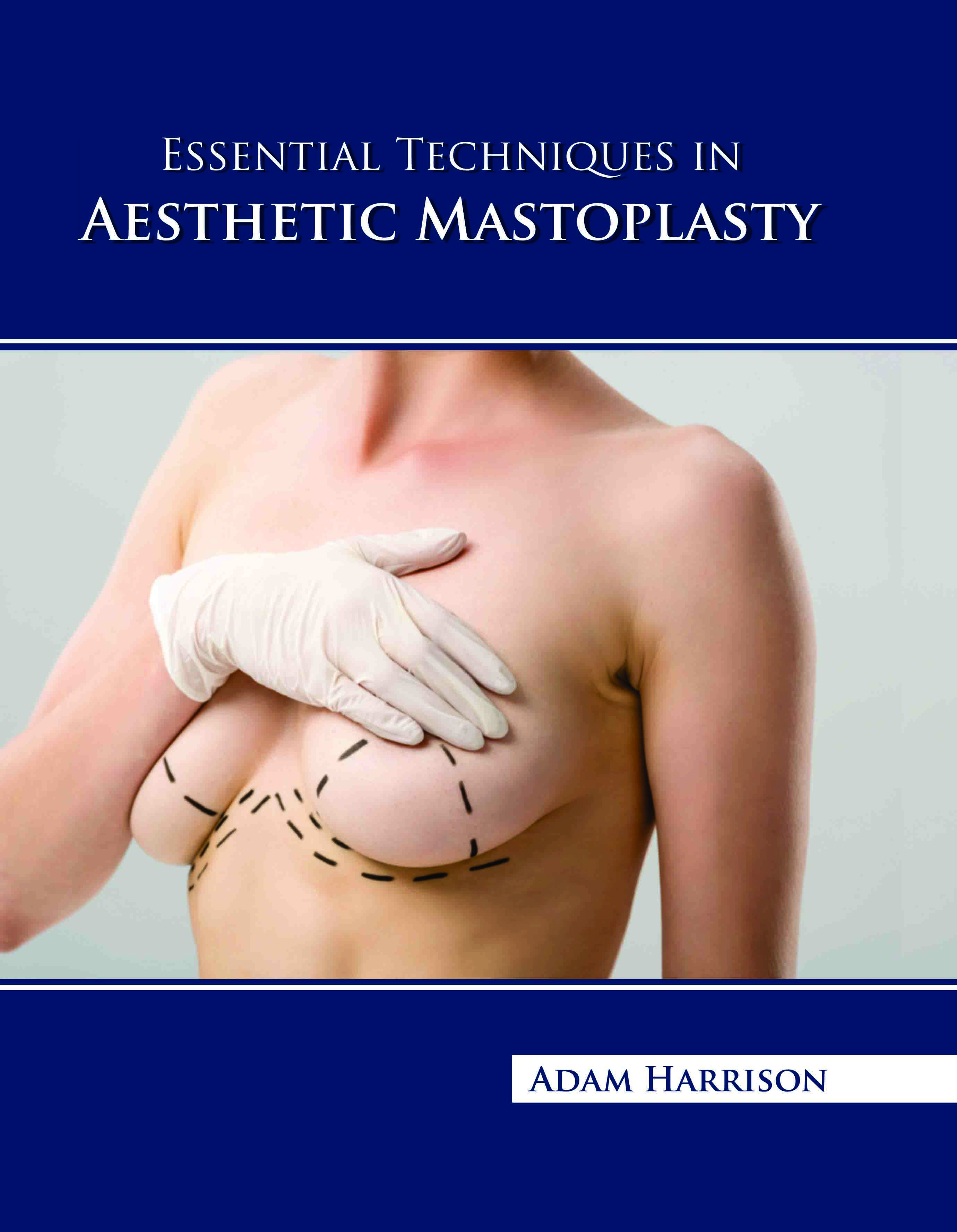 Essential Techniques in Aesthetic Mastoplasty
