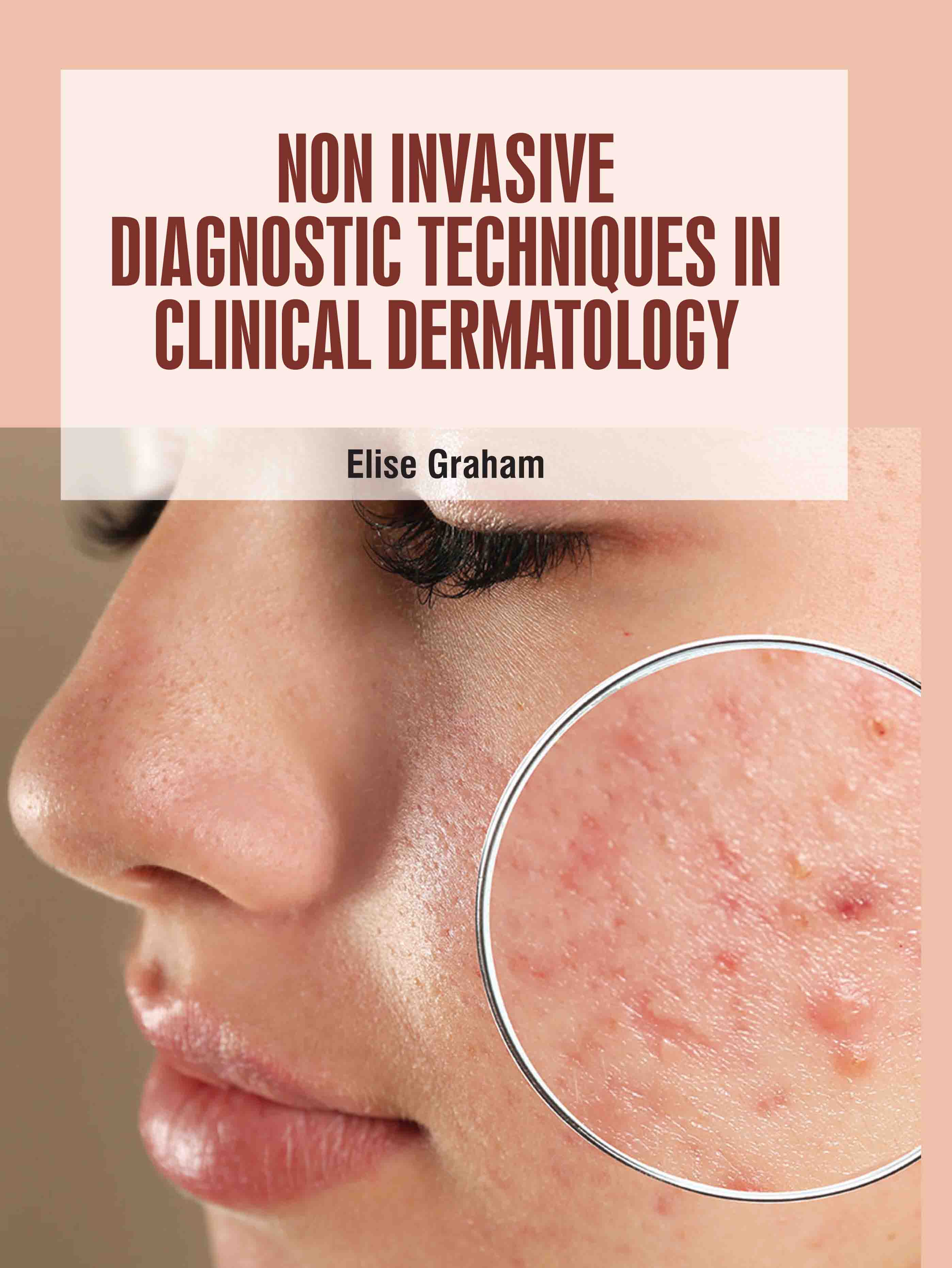 Non Invasive Diagnostic Techniques in Clinical Dermatology