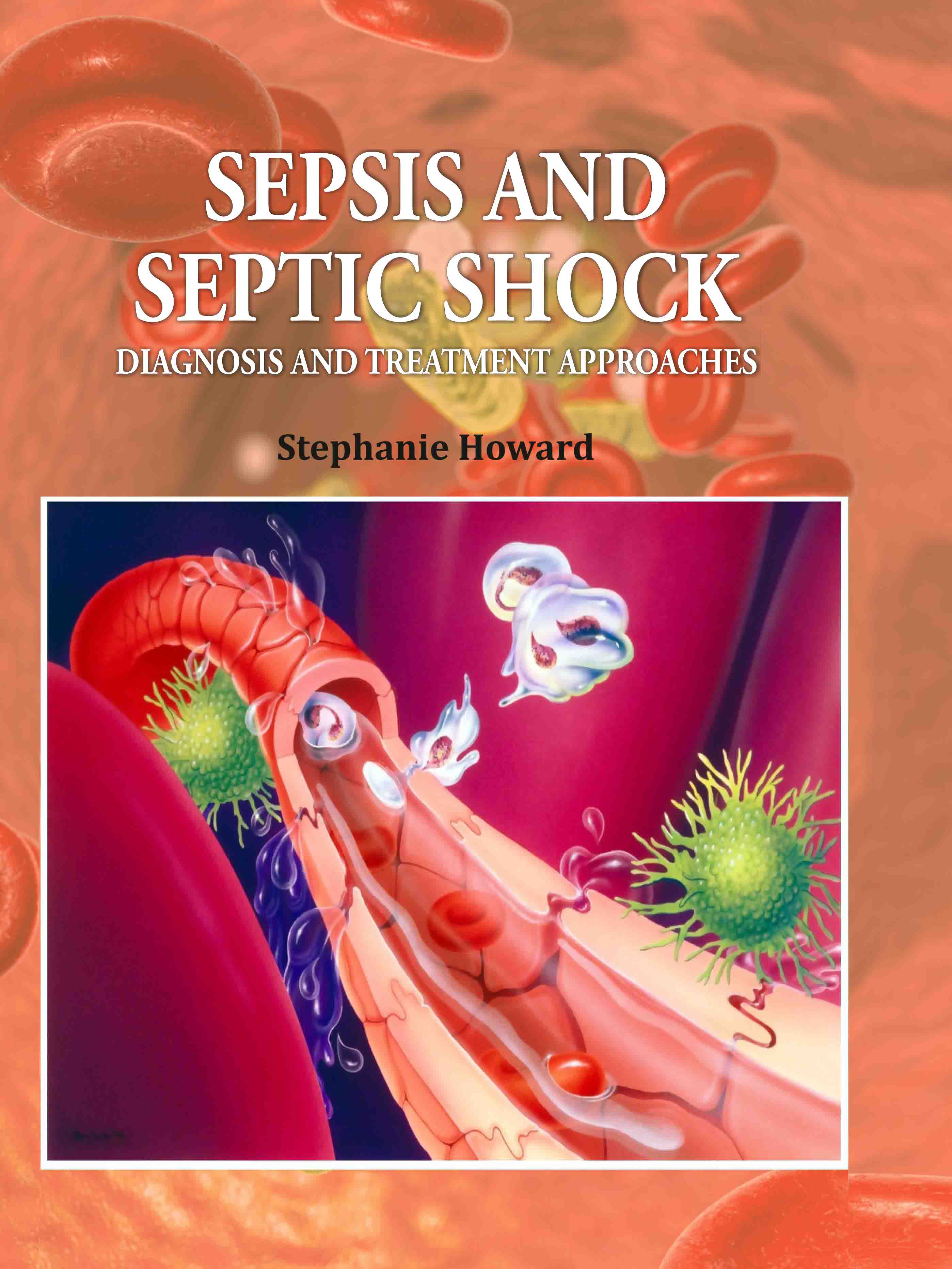 Sepsis and Septic Shock: Diagnosis and Treatment Approaches