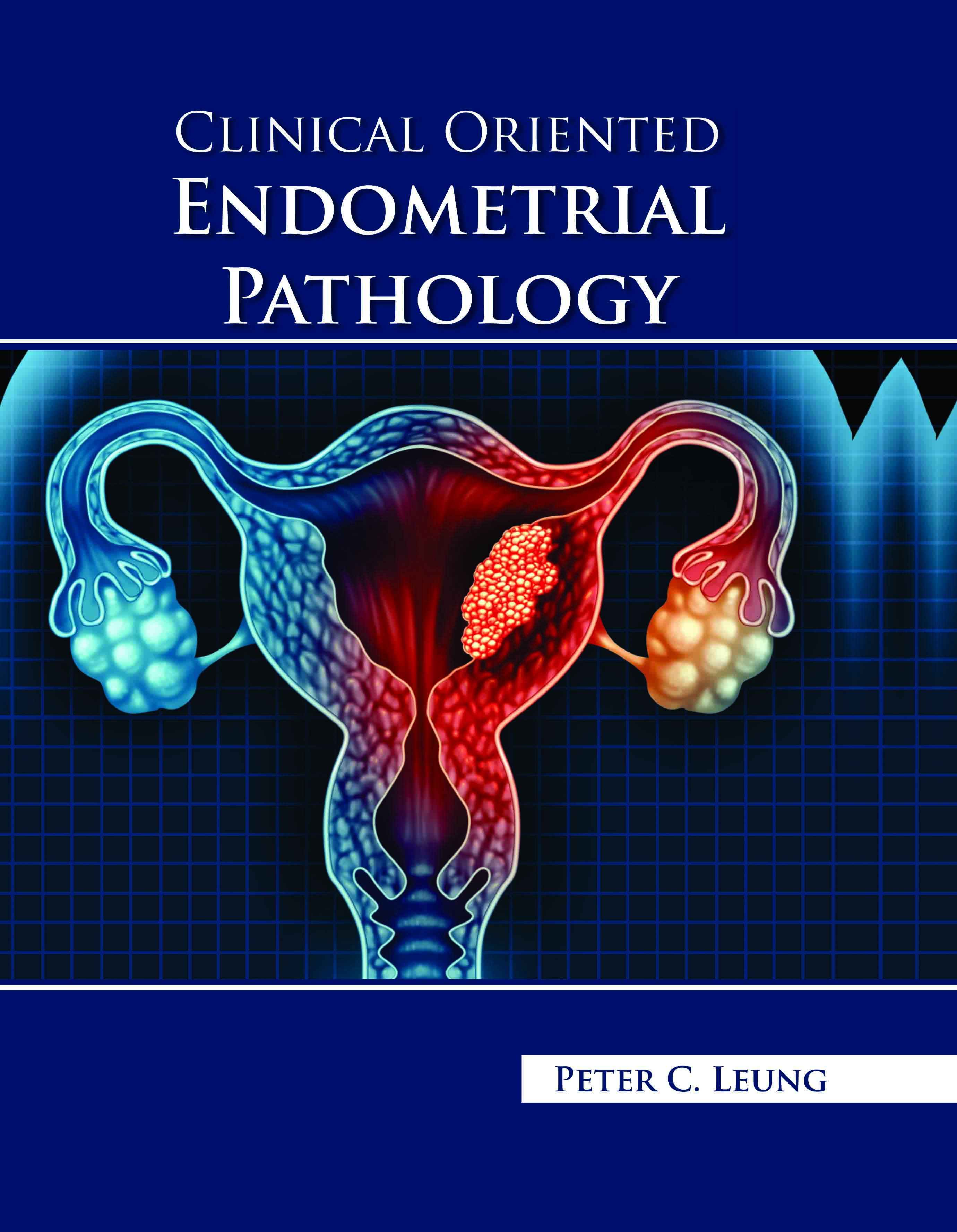 Clinical Oriented Endometrial Pathology
