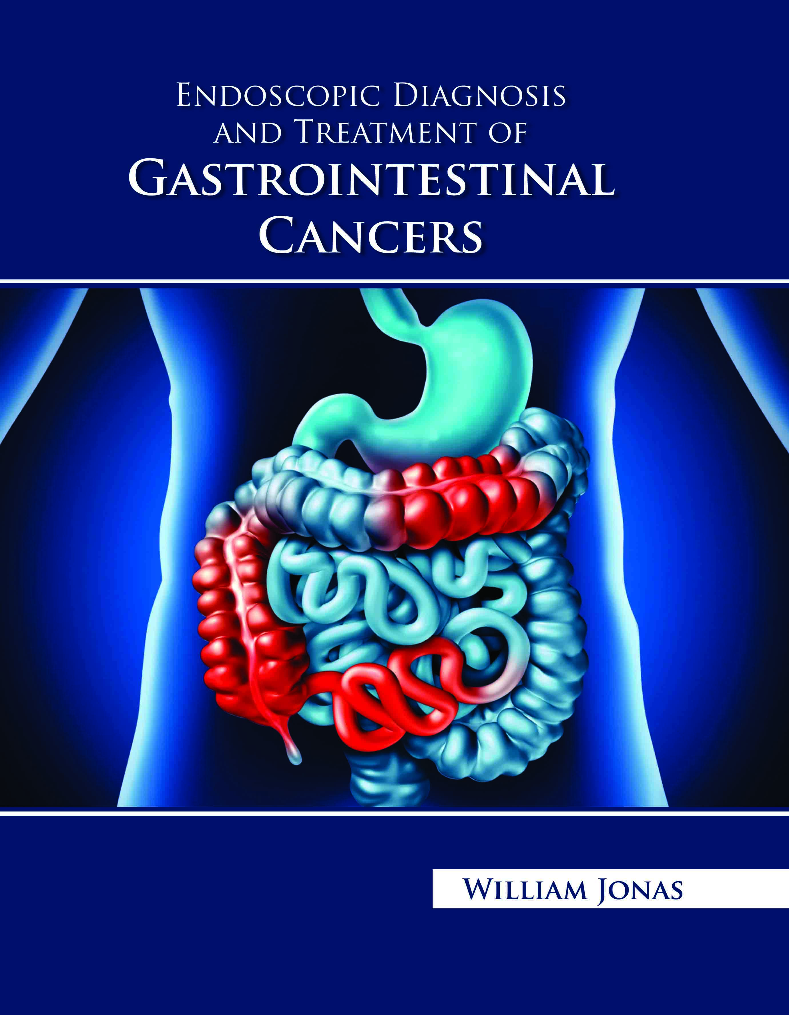 Endoscopic Diagnosis and Treatment of Gastrointestinal Cancers