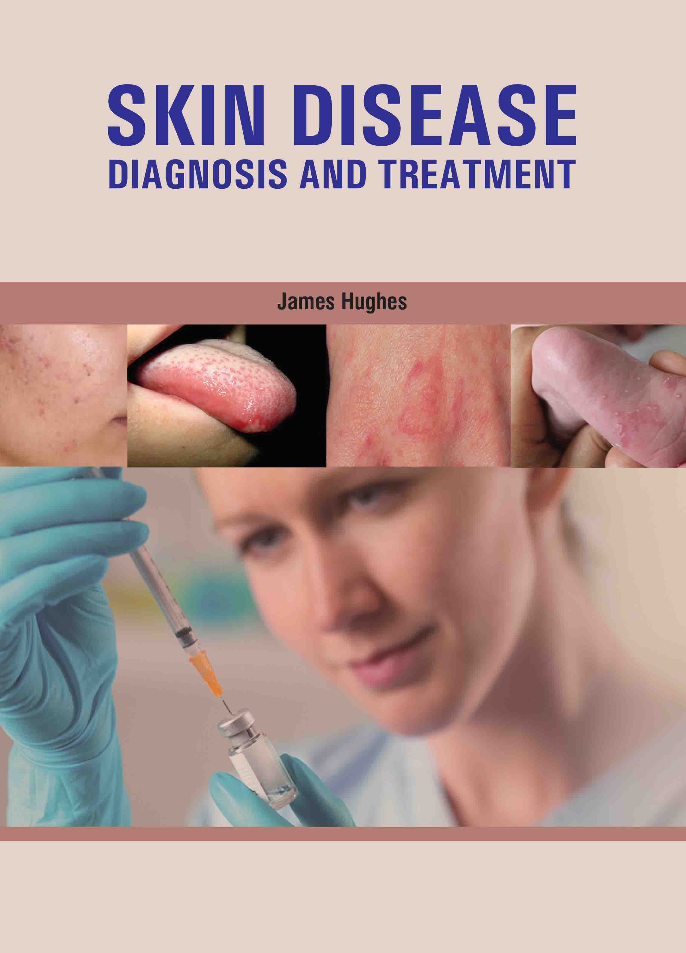 Skin Disease: Diagnosis and Treatment