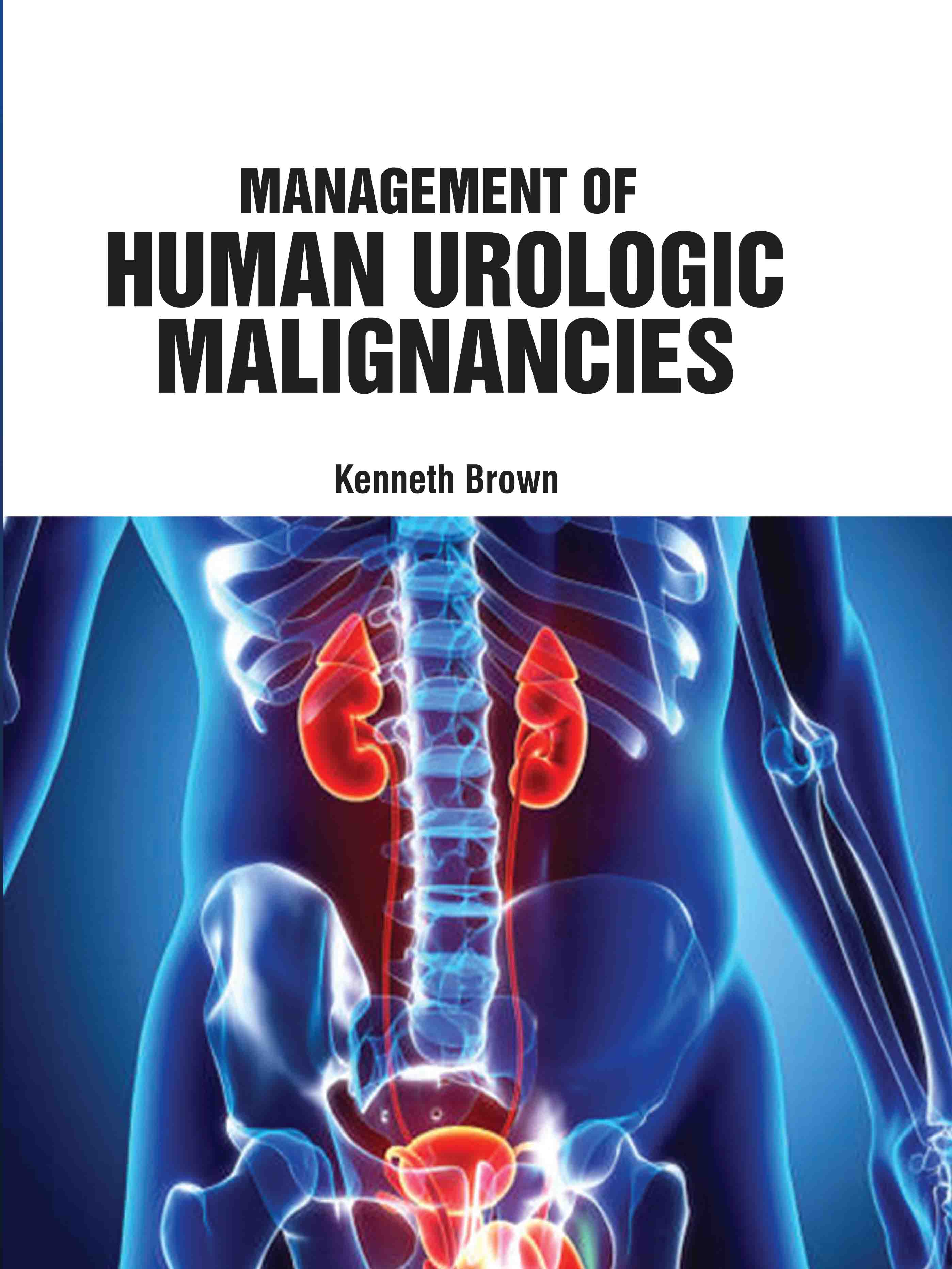 Management of Human Urologic Malignancies