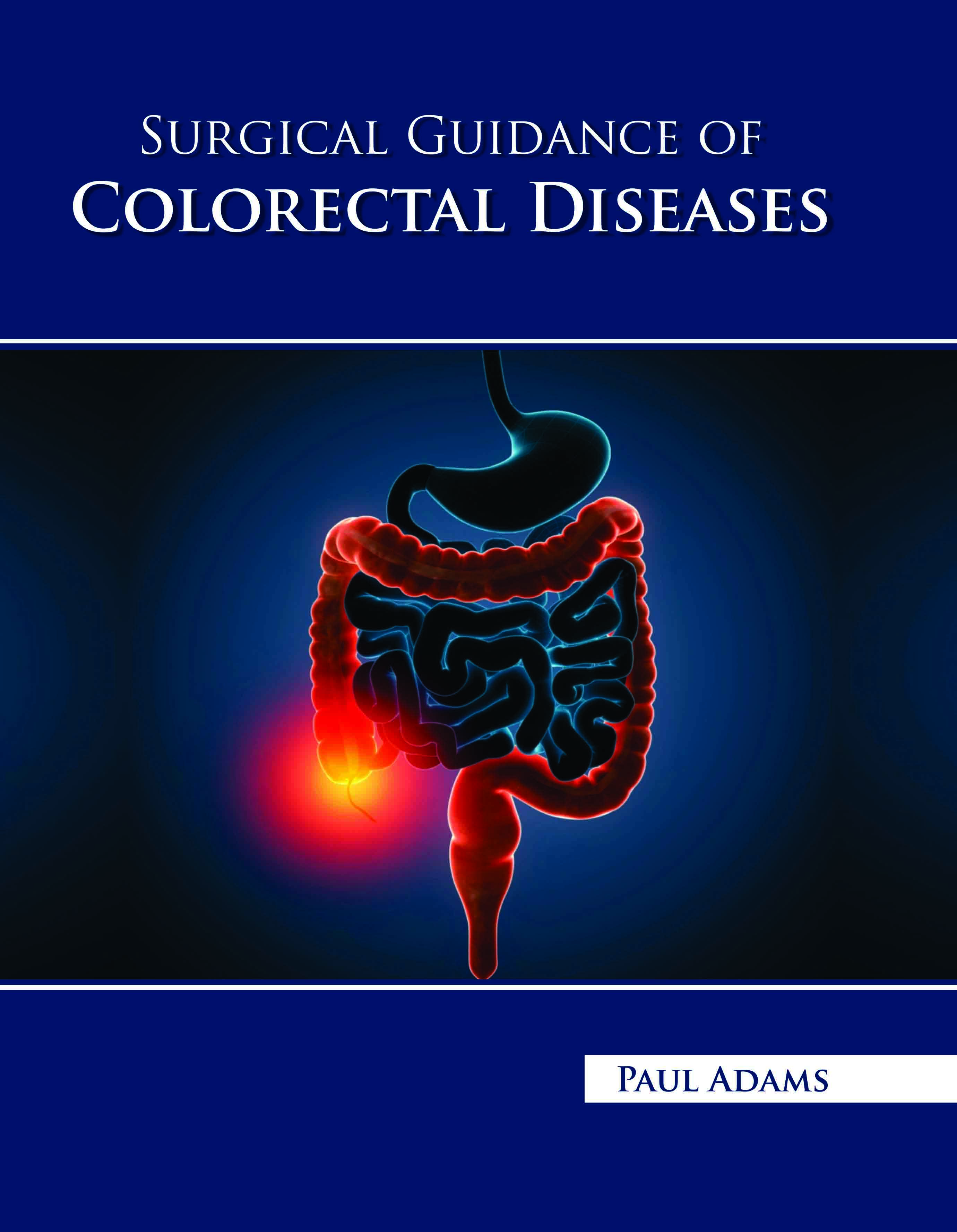 Surgical Guidance of Colorectal Diseases