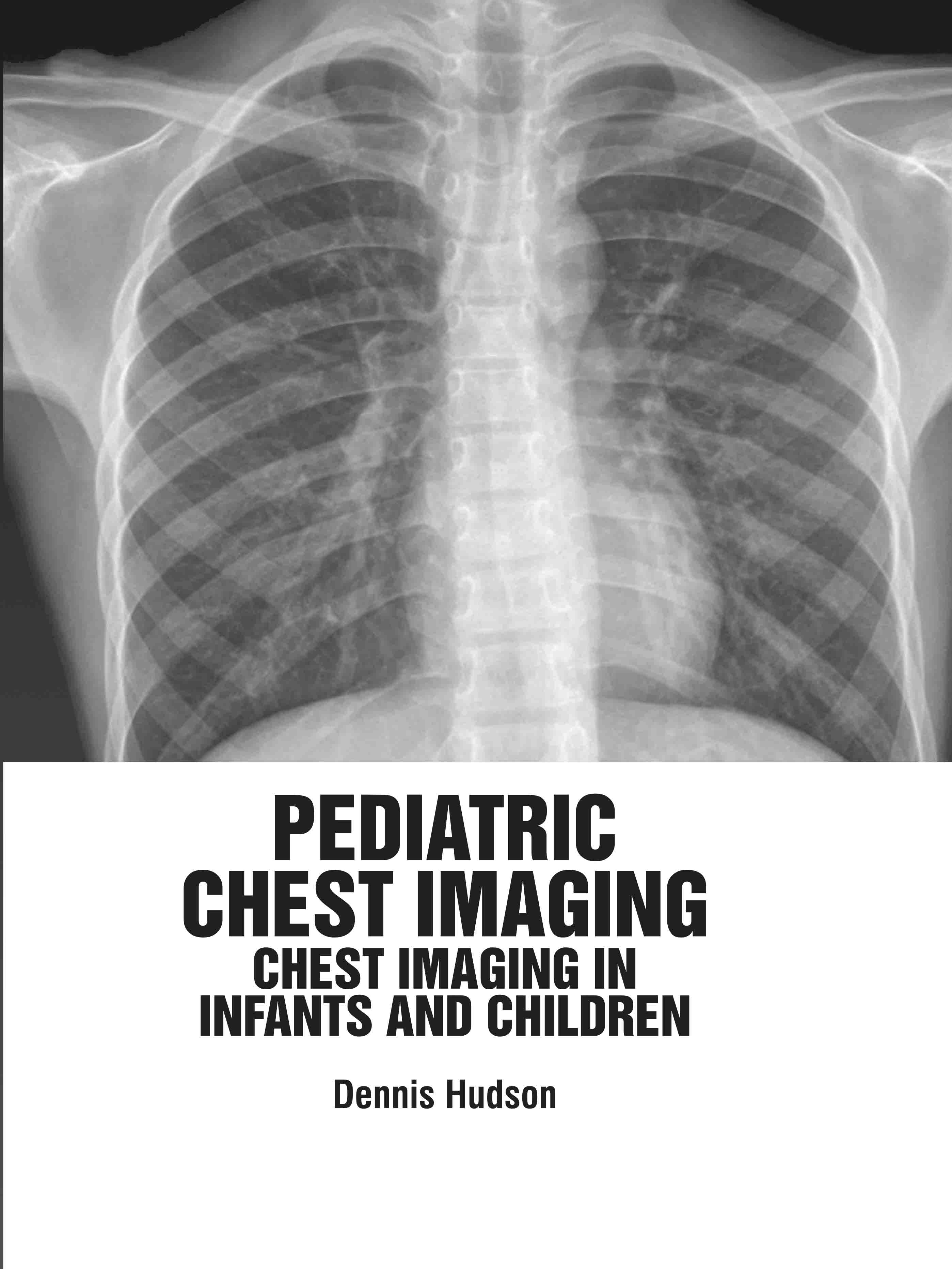 Pediatric Chest Imaging: Chest Imaging in Infants and Children