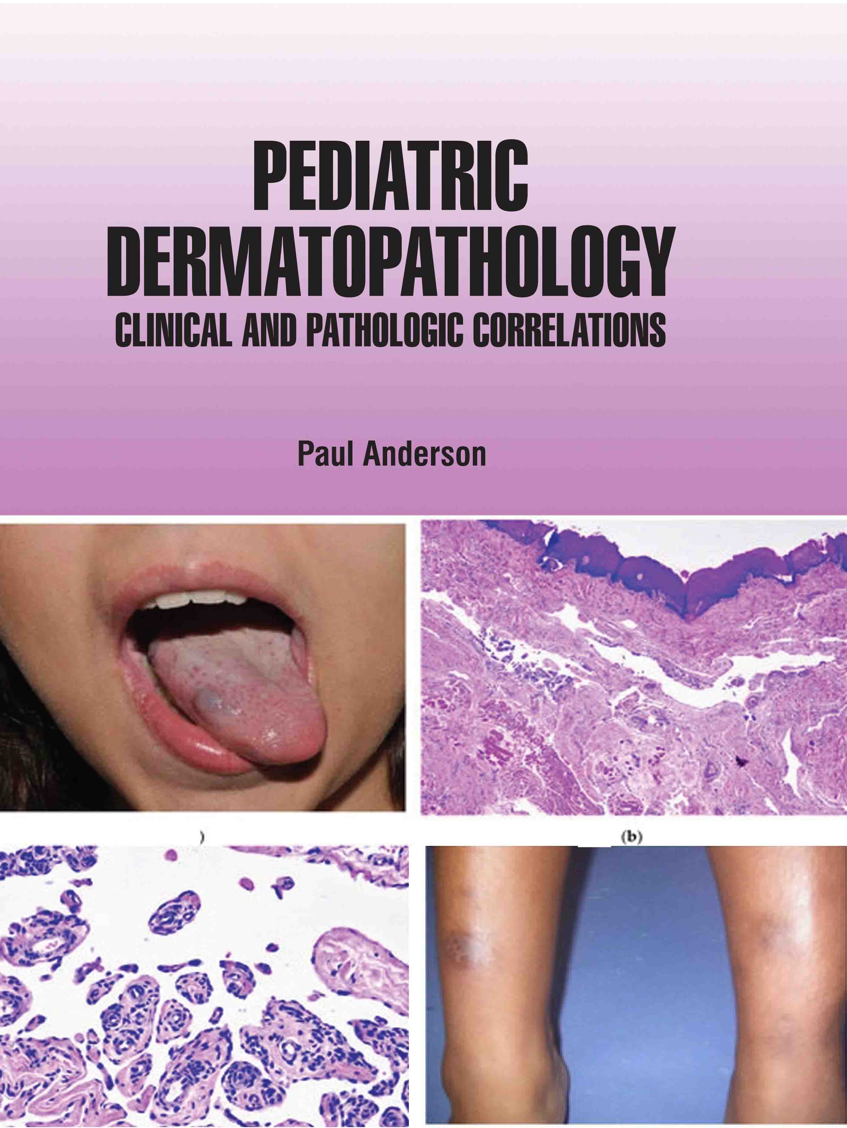Pediatric Dermatopathology: Clinical and Pathologic Correlations
