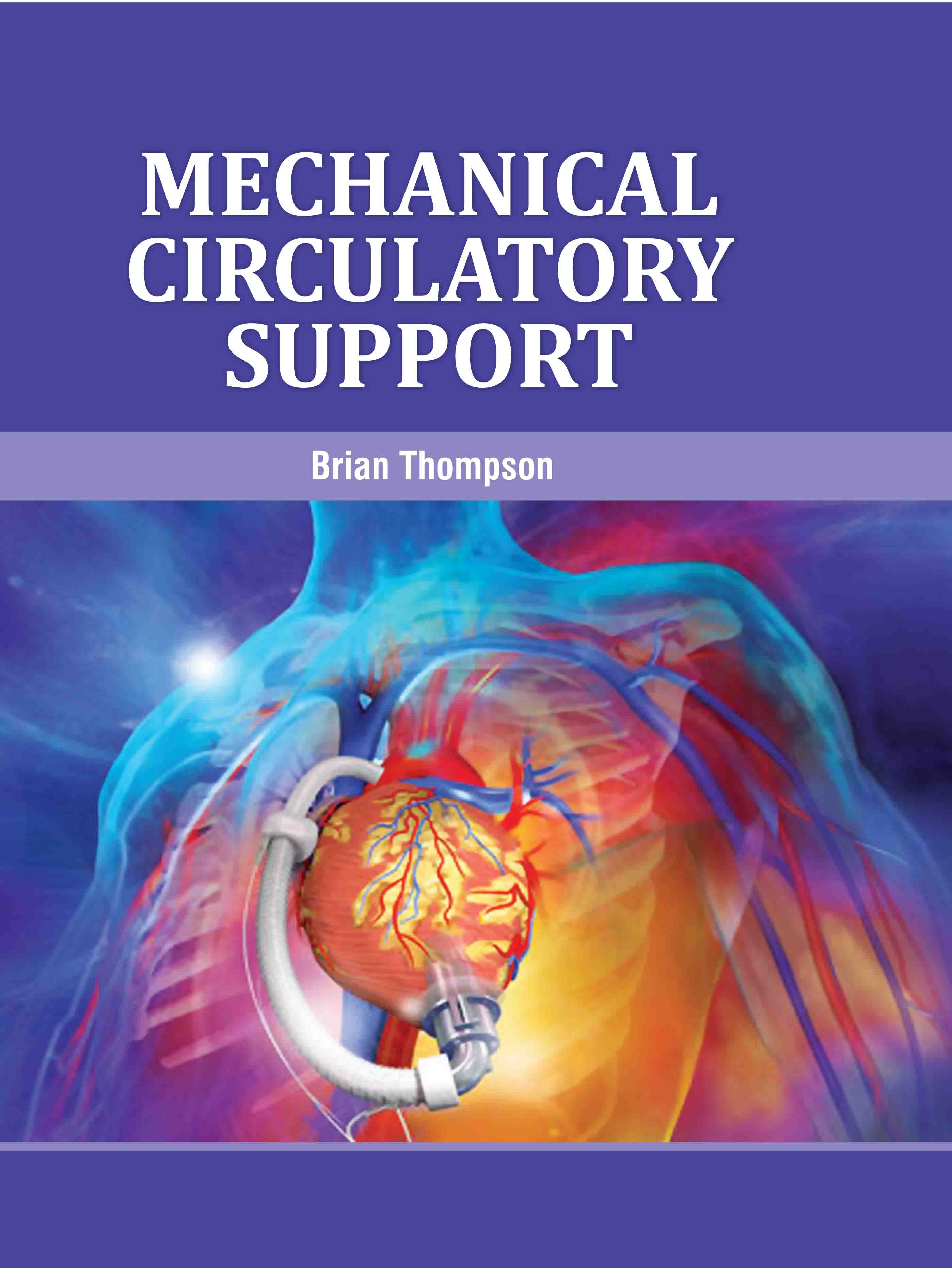 Mechanical Circulatory Support