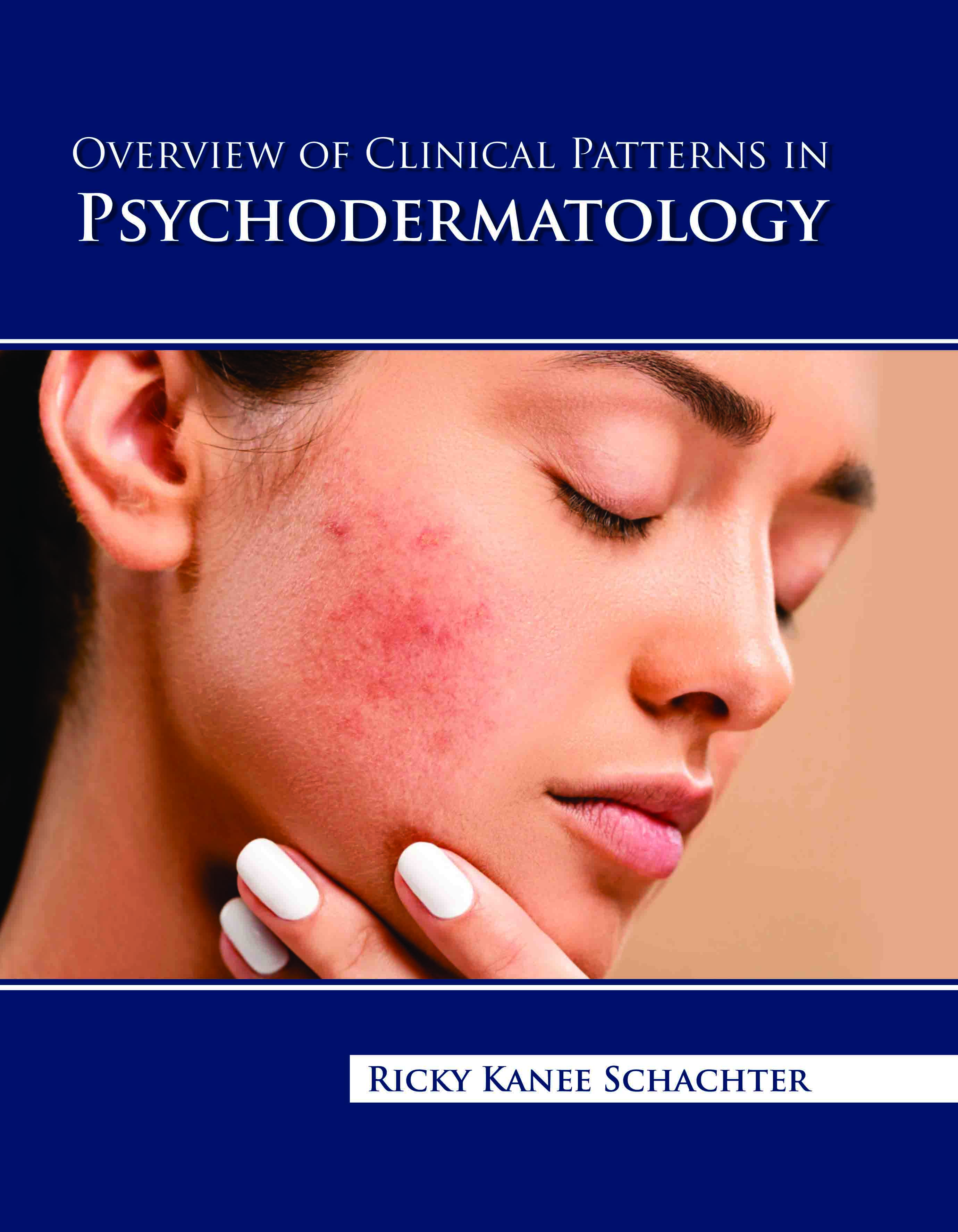 Overview of Clinical Patterns in Psychodermatology