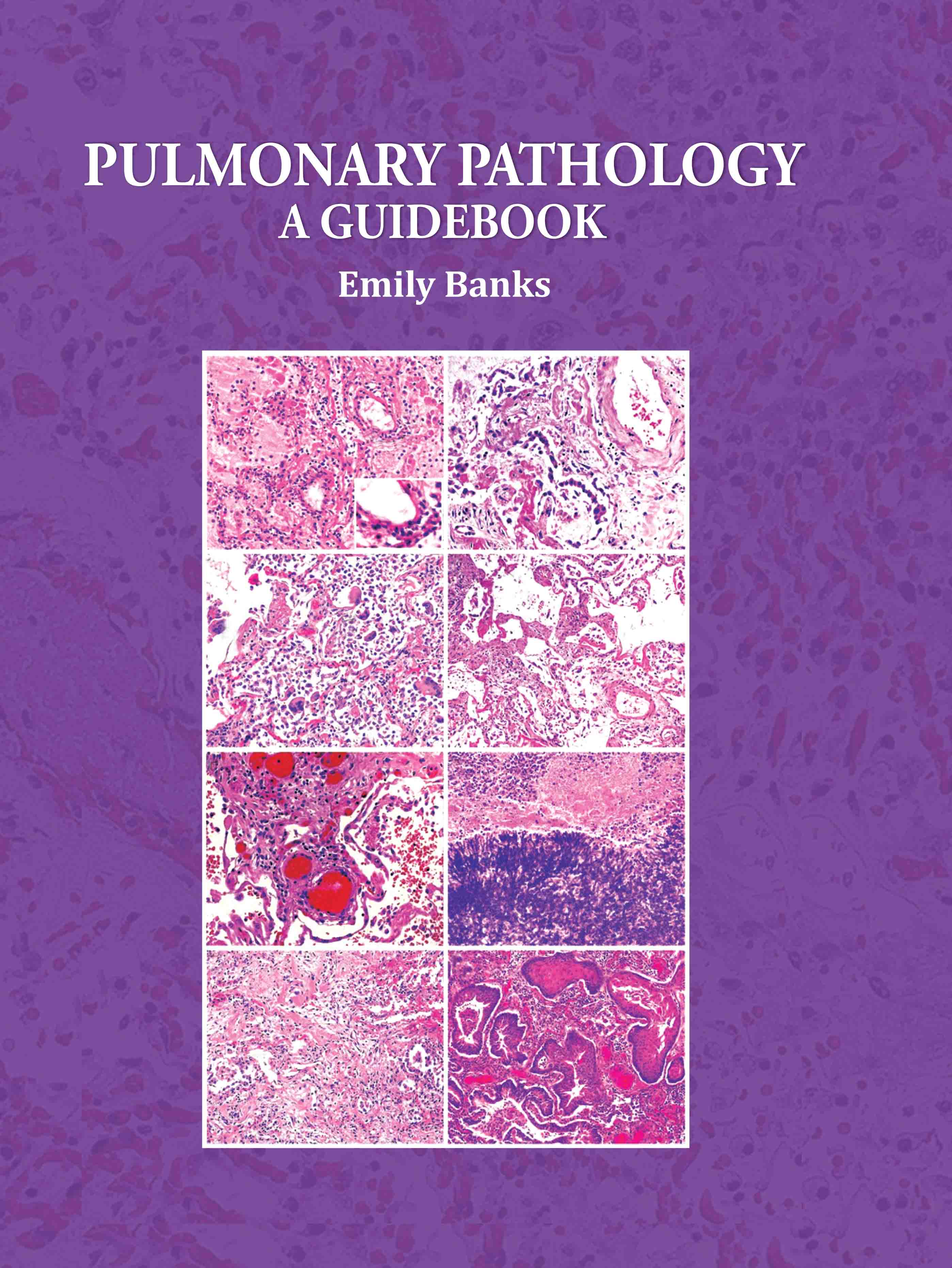 Pulmonary Pathology: A Guidebook