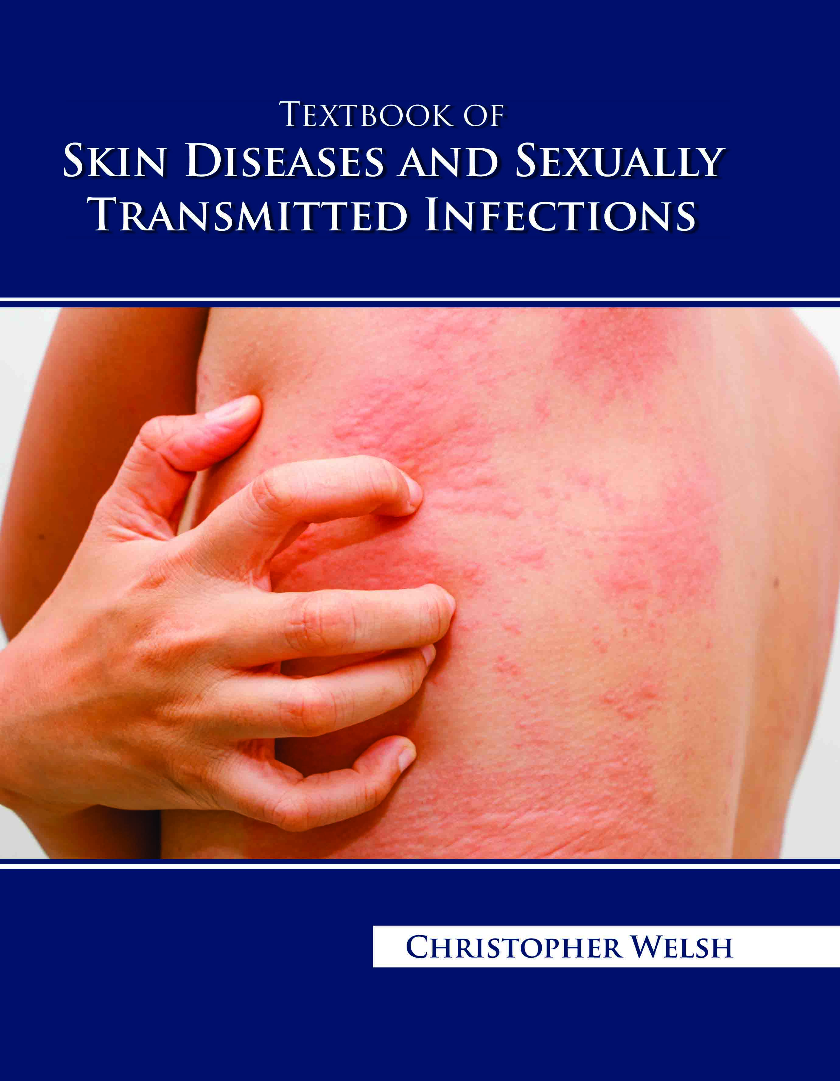 Textbook of Skin Diseases and Sexually Transmitted Infections