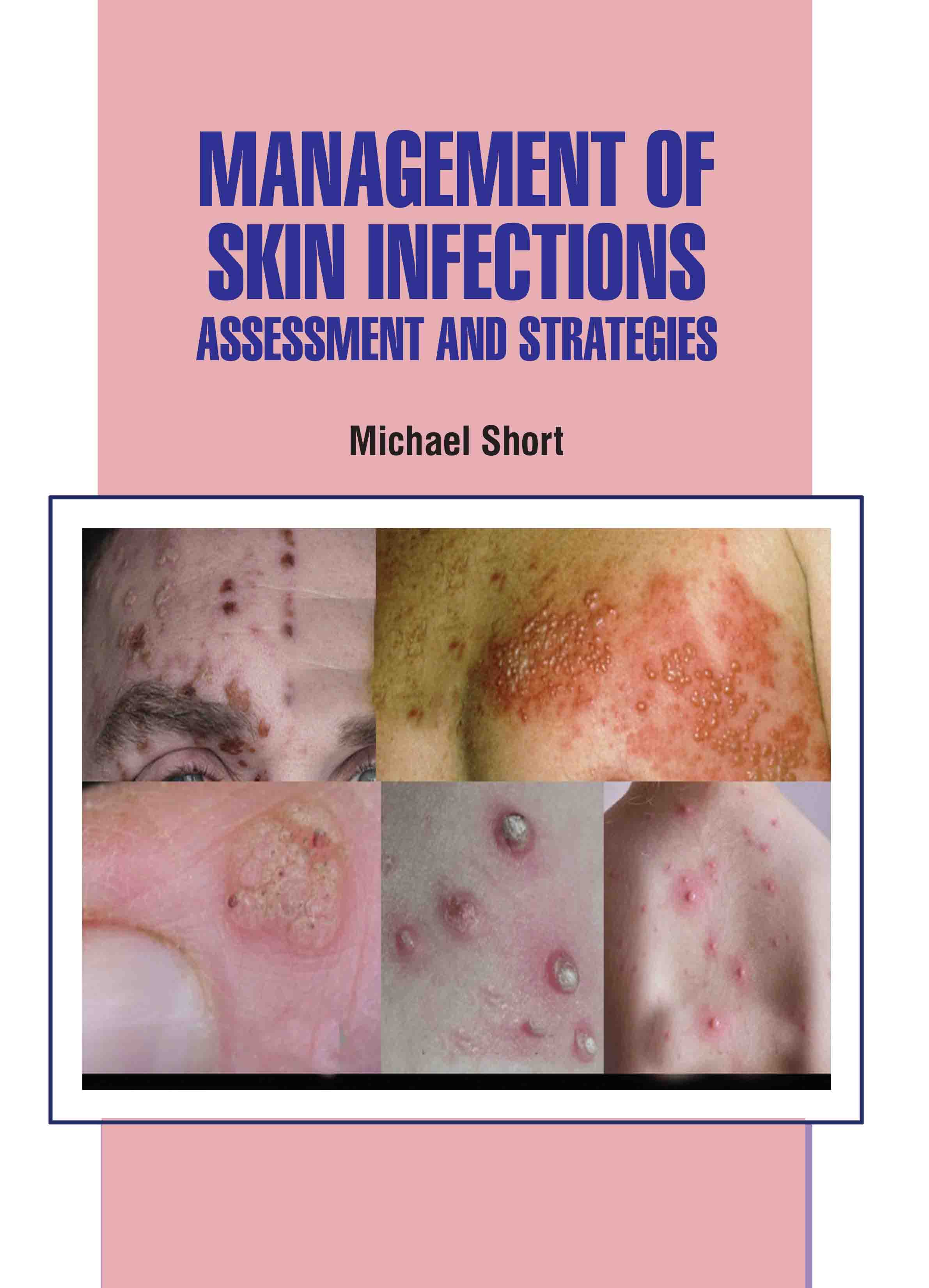 Management of Skin Infections: Assessment and Strategies