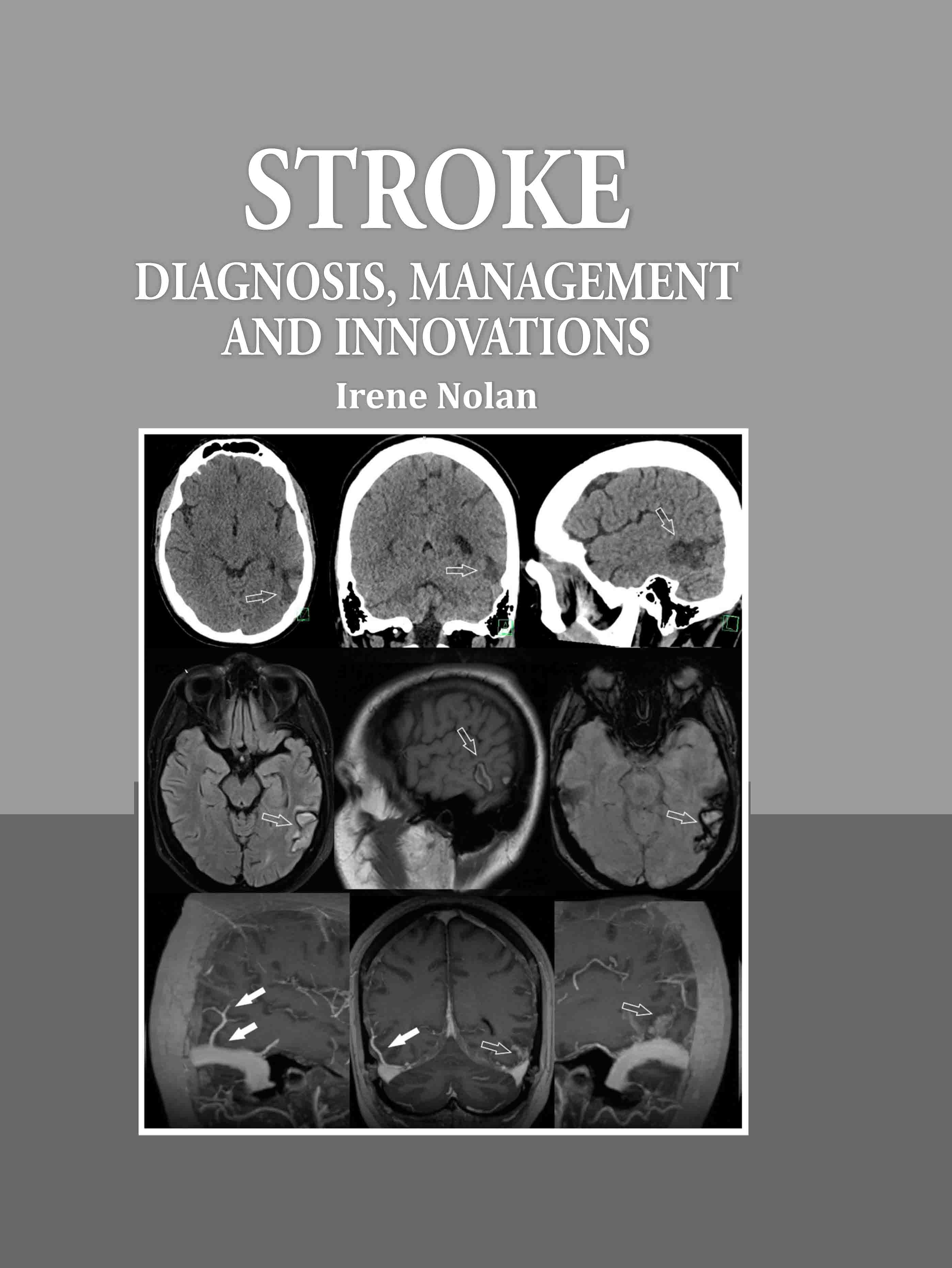 Stroke: Diagnosis, Management, and Innovations