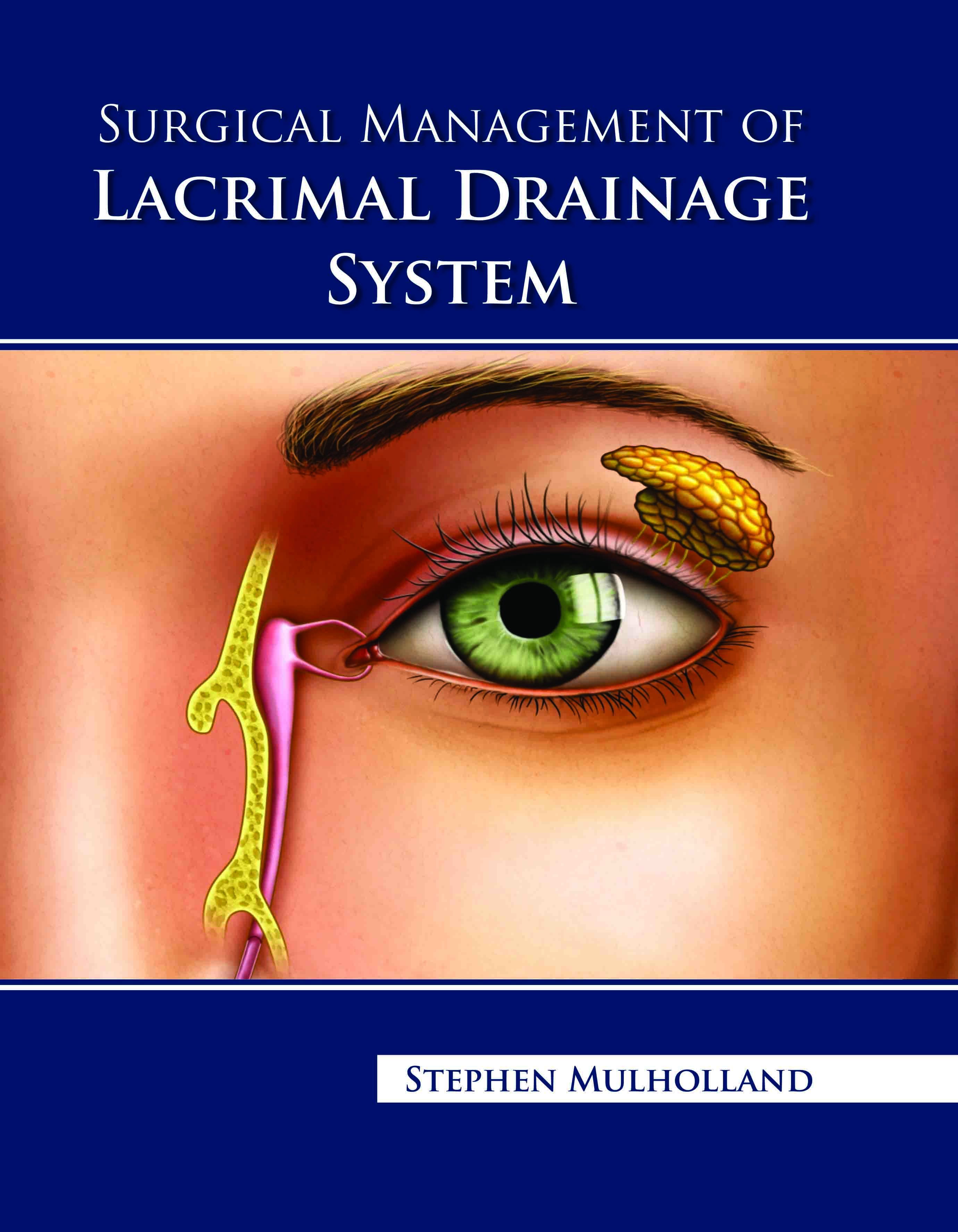 Surgical Management of Lacrimal Drainage System