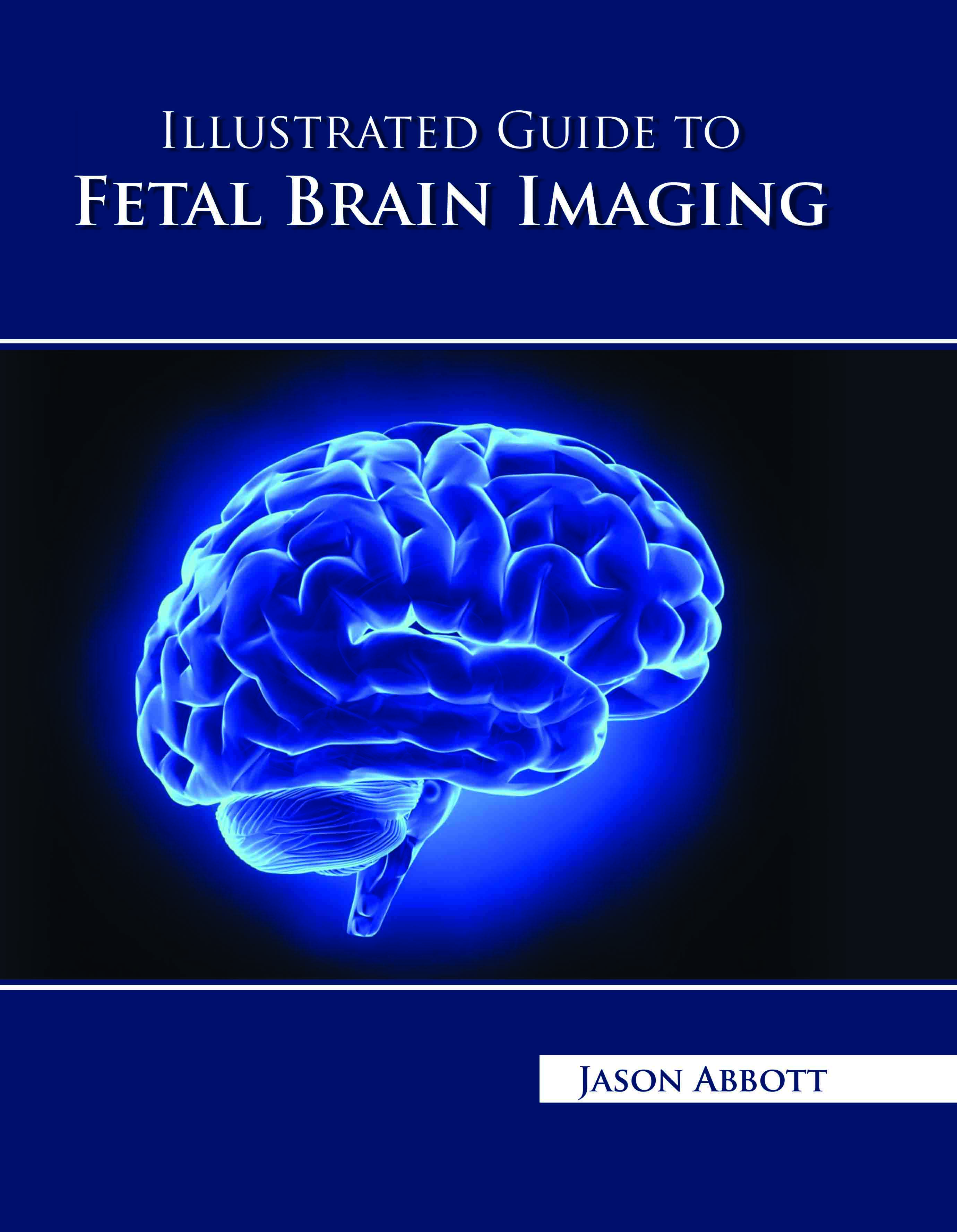 Illustrated Guide to Fetal Brain Imaging