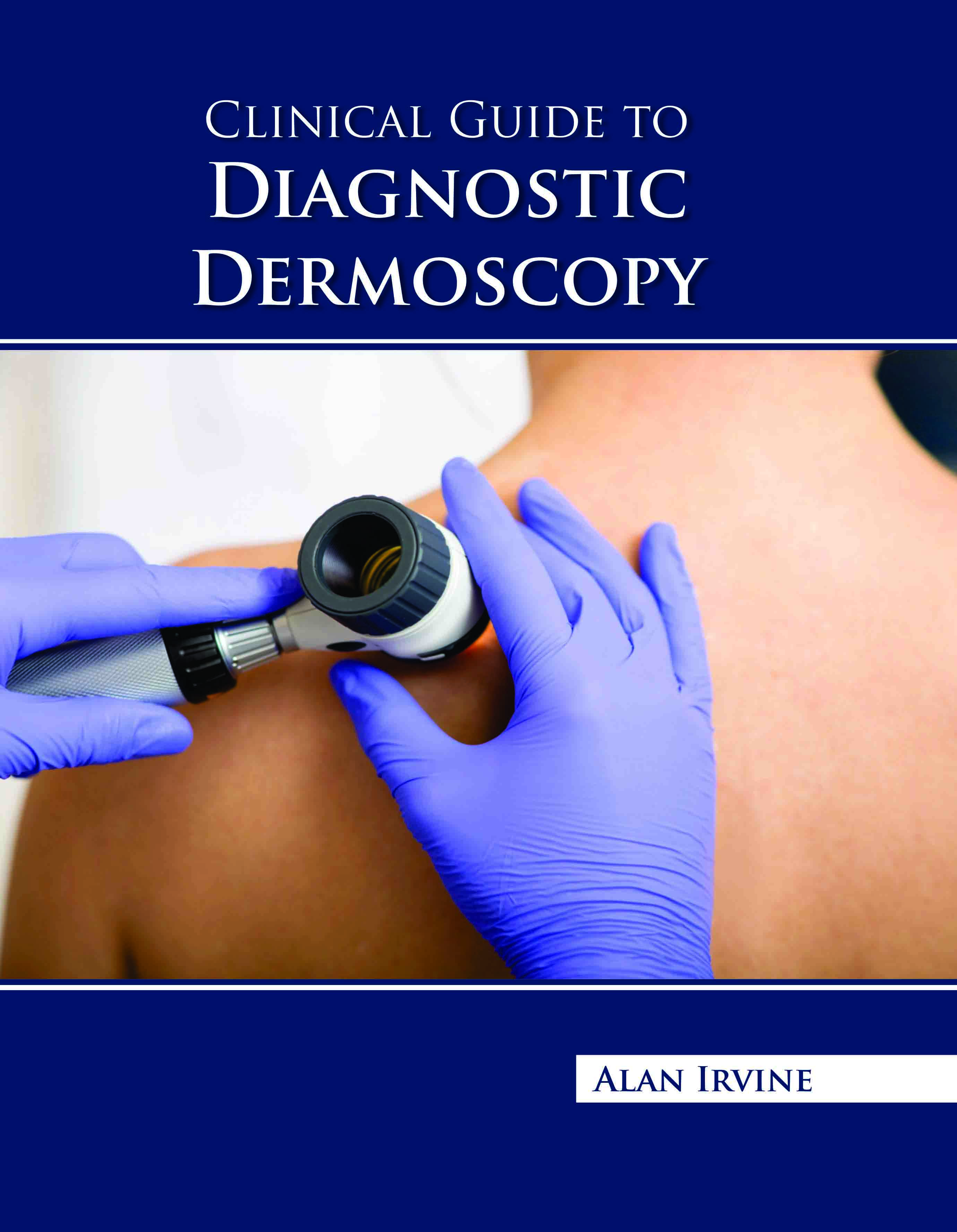 Clinical Guide to Diagnostic Dermoscopy 