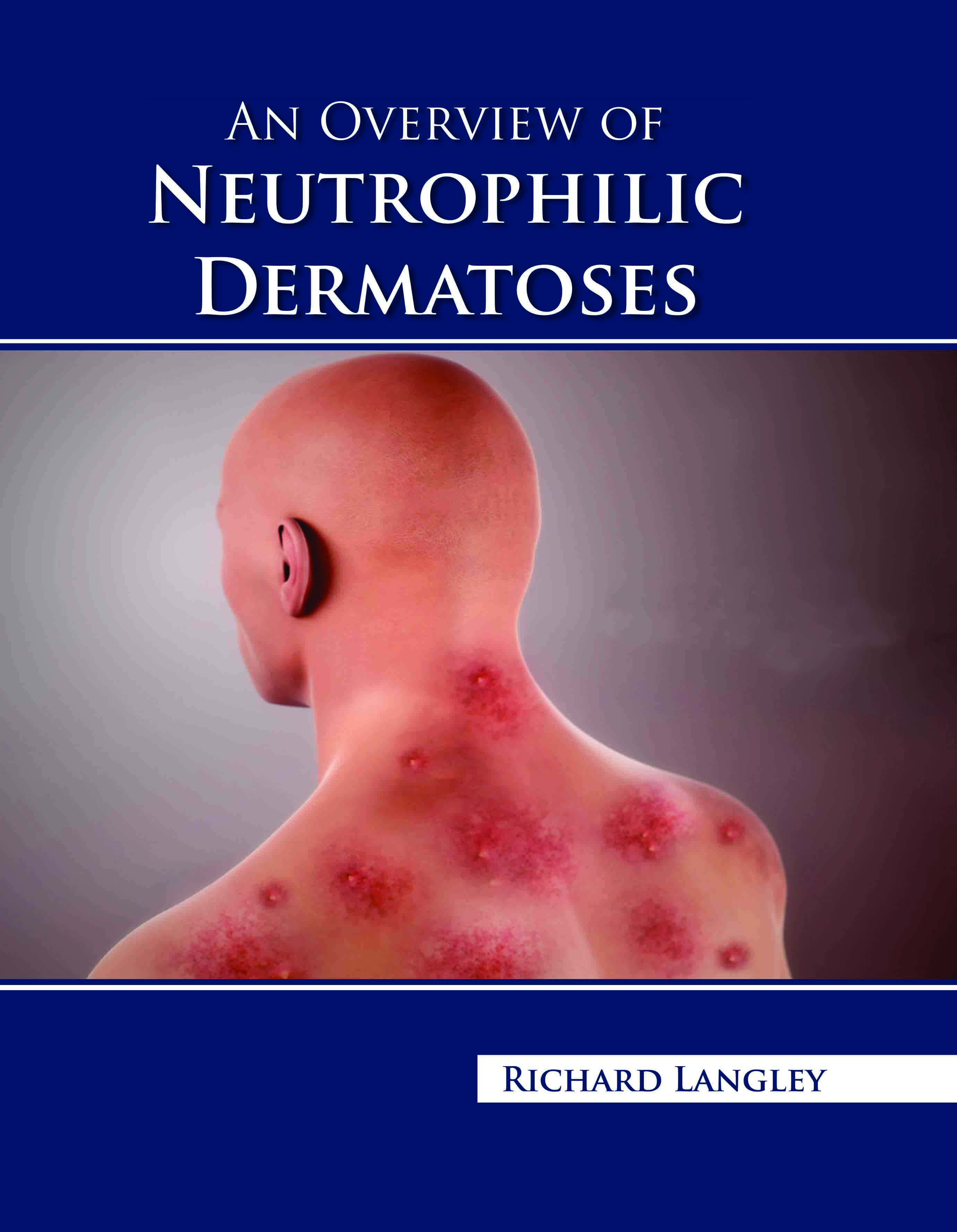 An Overview of Neutrophilic Dermatoses