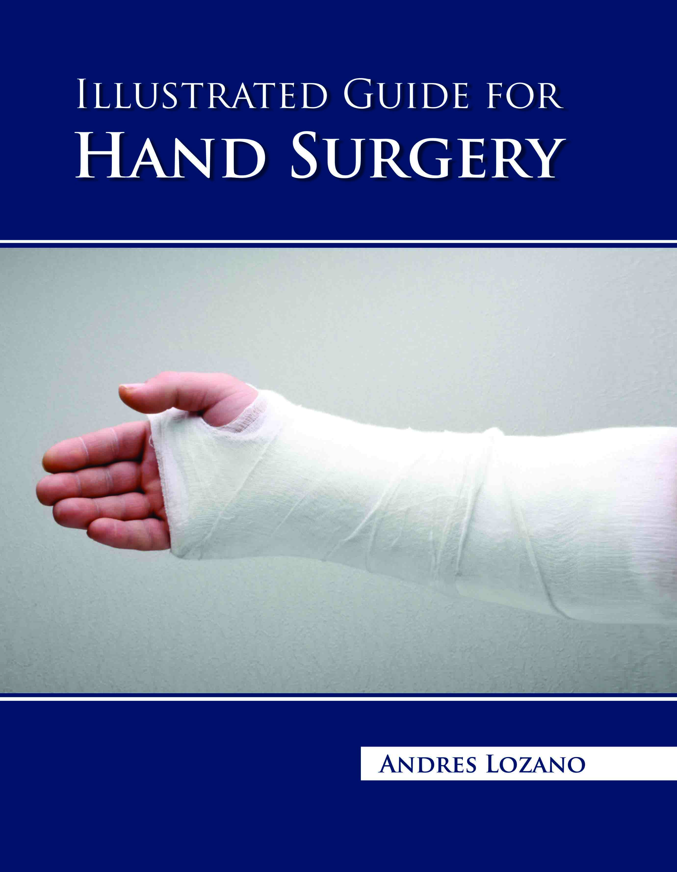 Illustrated Guide for Hand Surgery