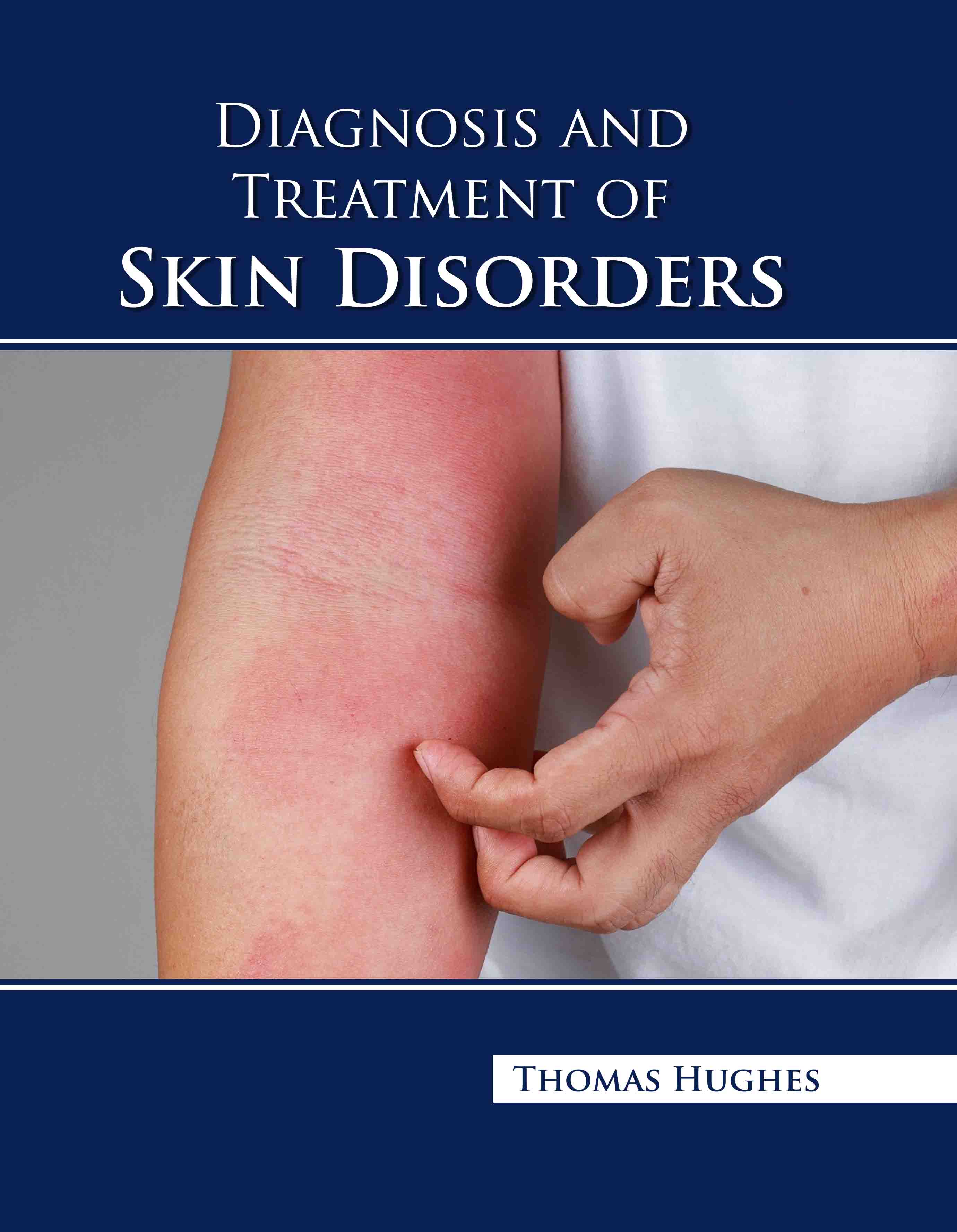 Diagnosis and Treatment of Skin Disorders
