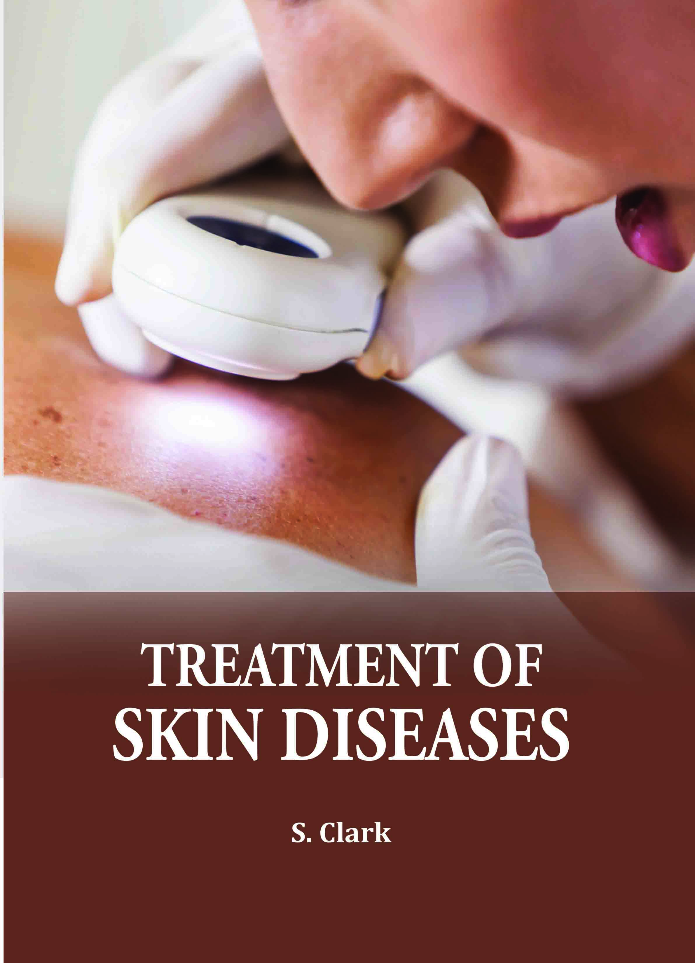 Treatment of Skin Diseases