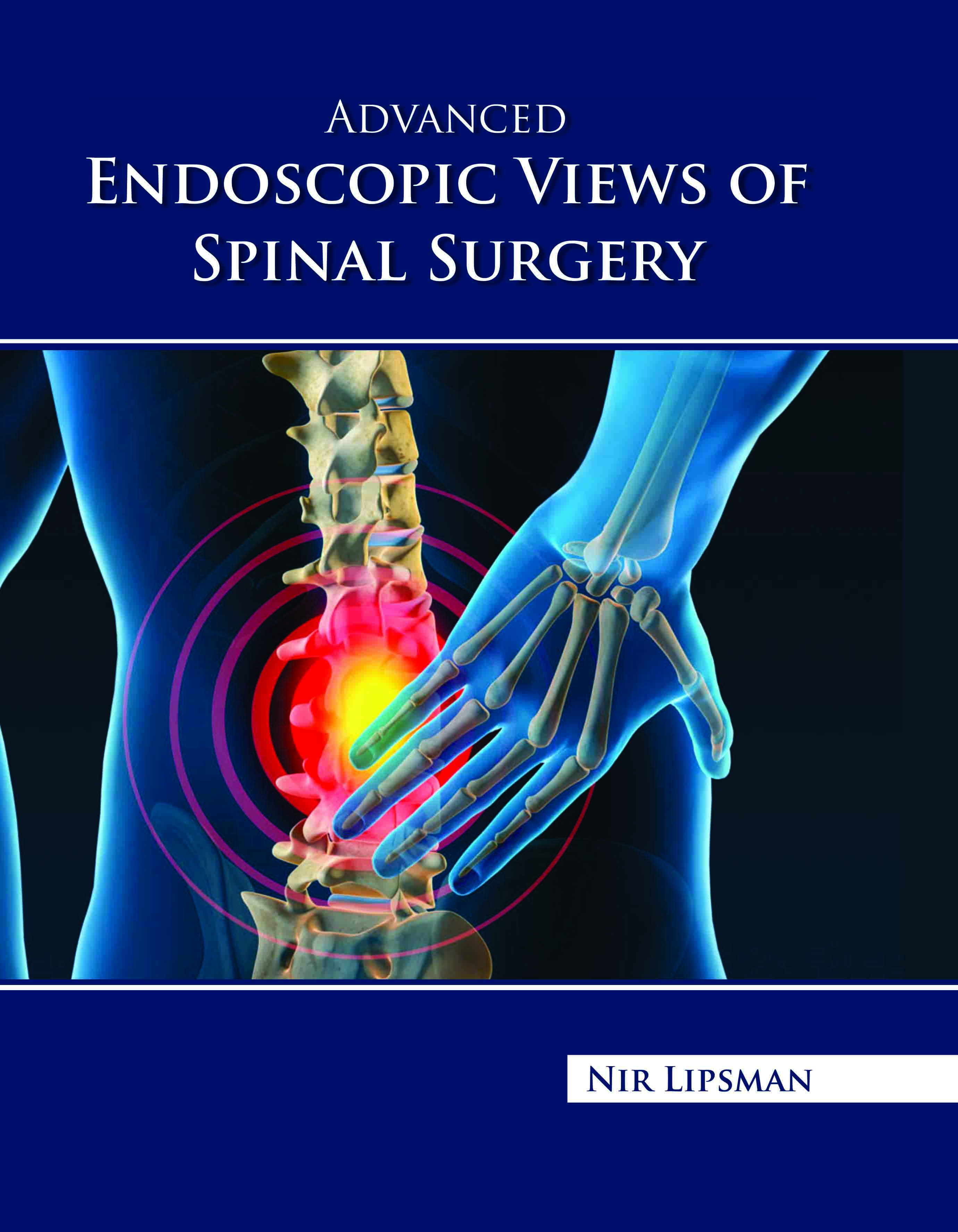 Advanced Endoscopic Views of Spinal Surgery